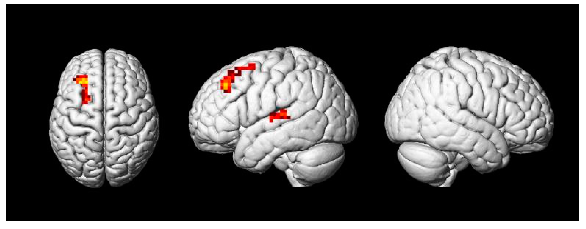 Brainsci 11 00983 g007 550