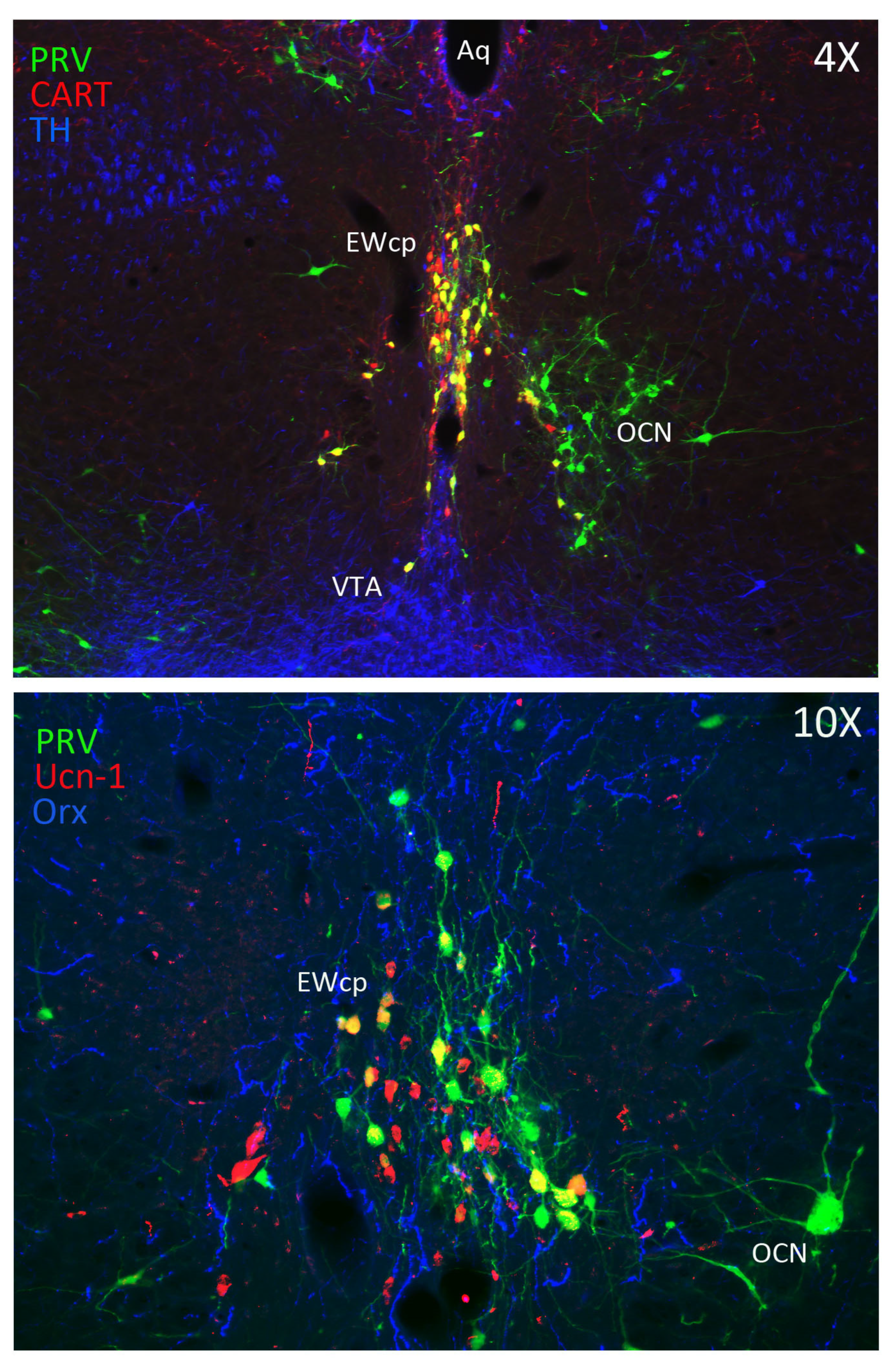 Brain Sciences Free Full Text Centrally Projecting Edinger Westphal Nucleus In The Control Of Sympathetic Outflow And Energy Homeostasis Html