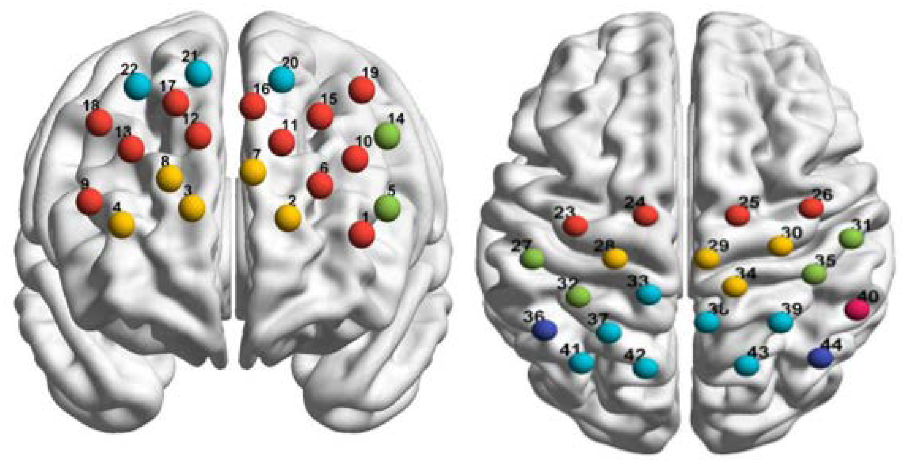 Brainsci 11 01052 g004 Brainsci 11 01052 g004