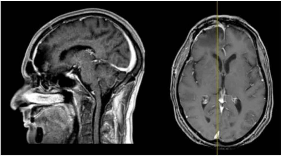 Brainsci 11 01076 g002