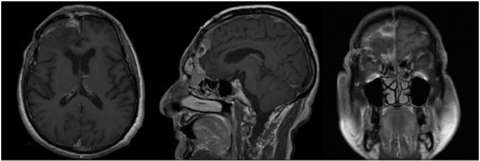 Brainsci 11 01076 g003