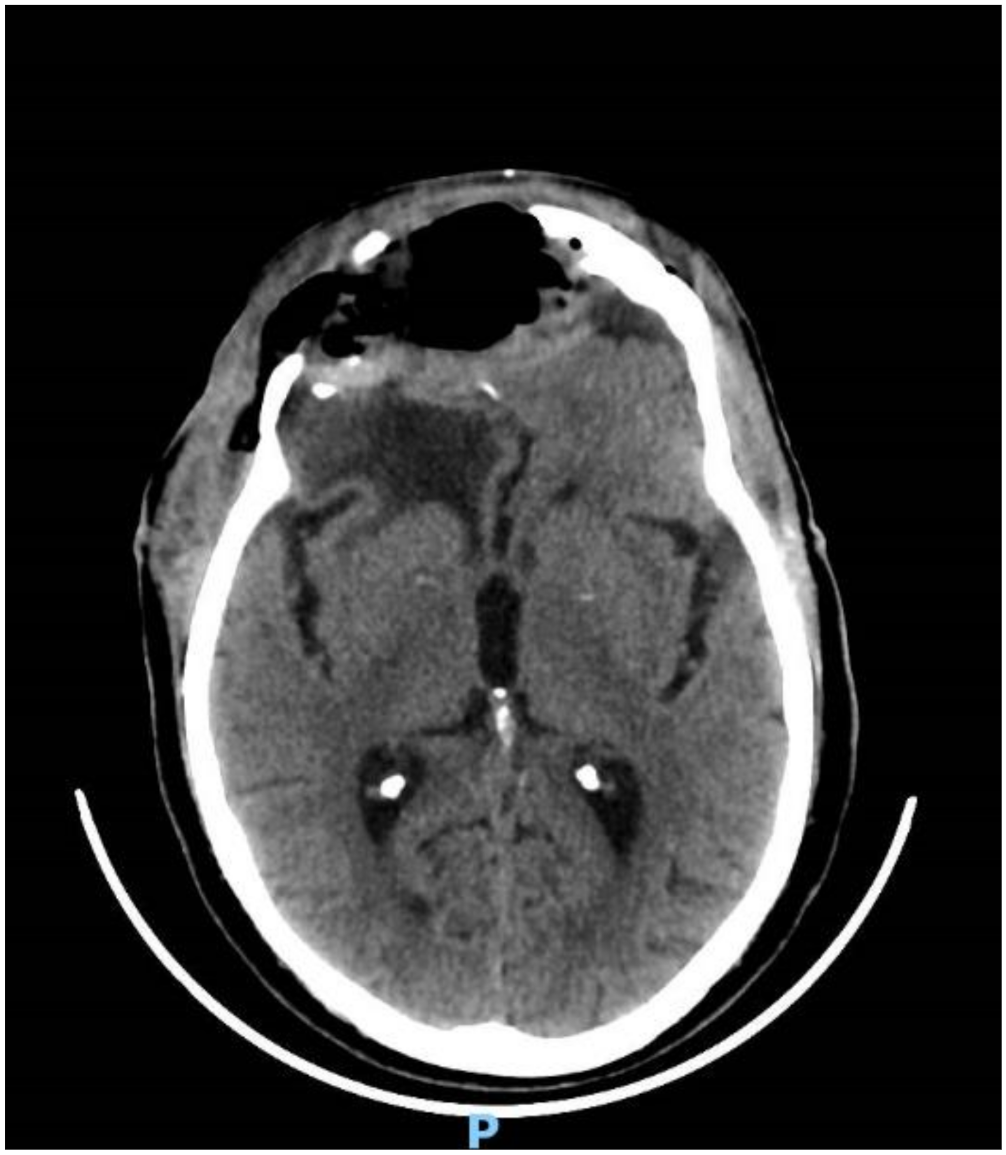 Brainsci 11 01076 g005