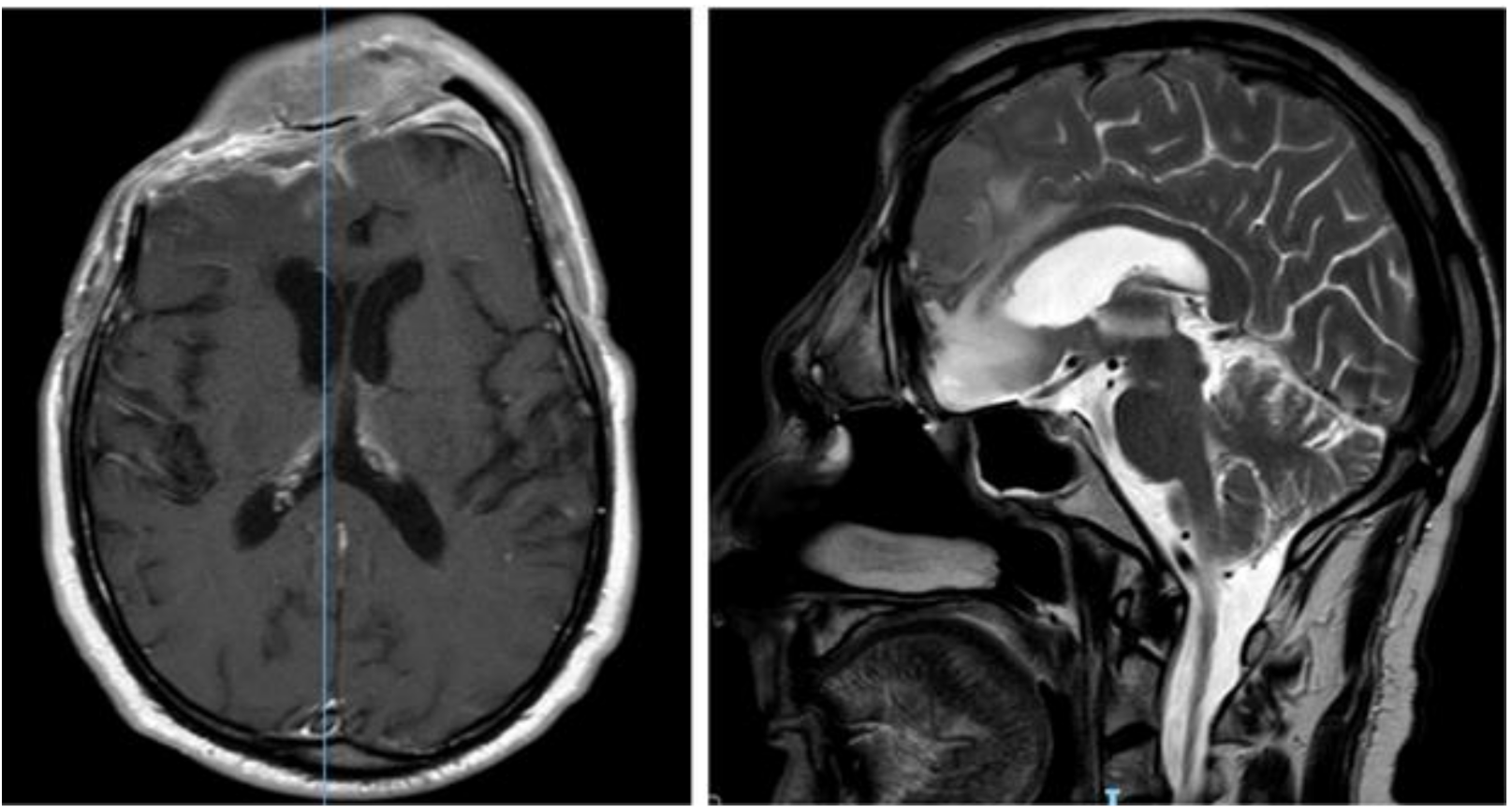Brainsci 11 01076 g006