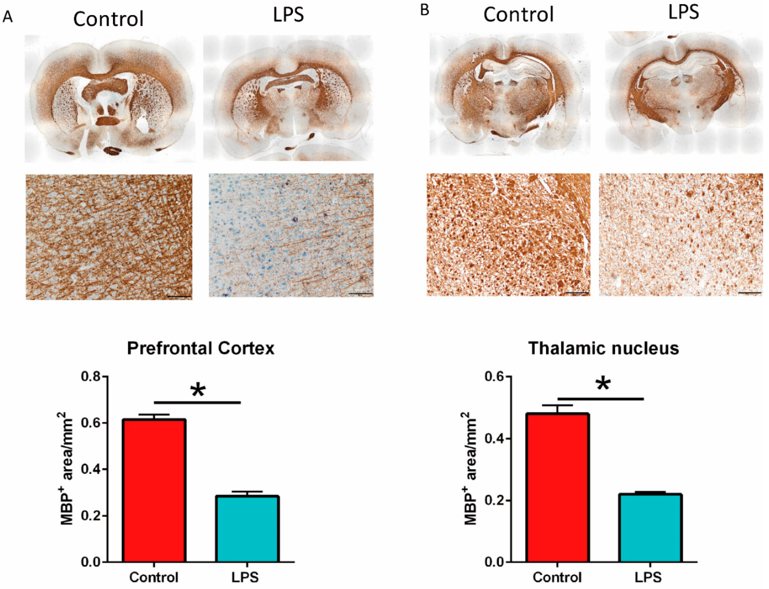 Brainsci 11 01085 g006