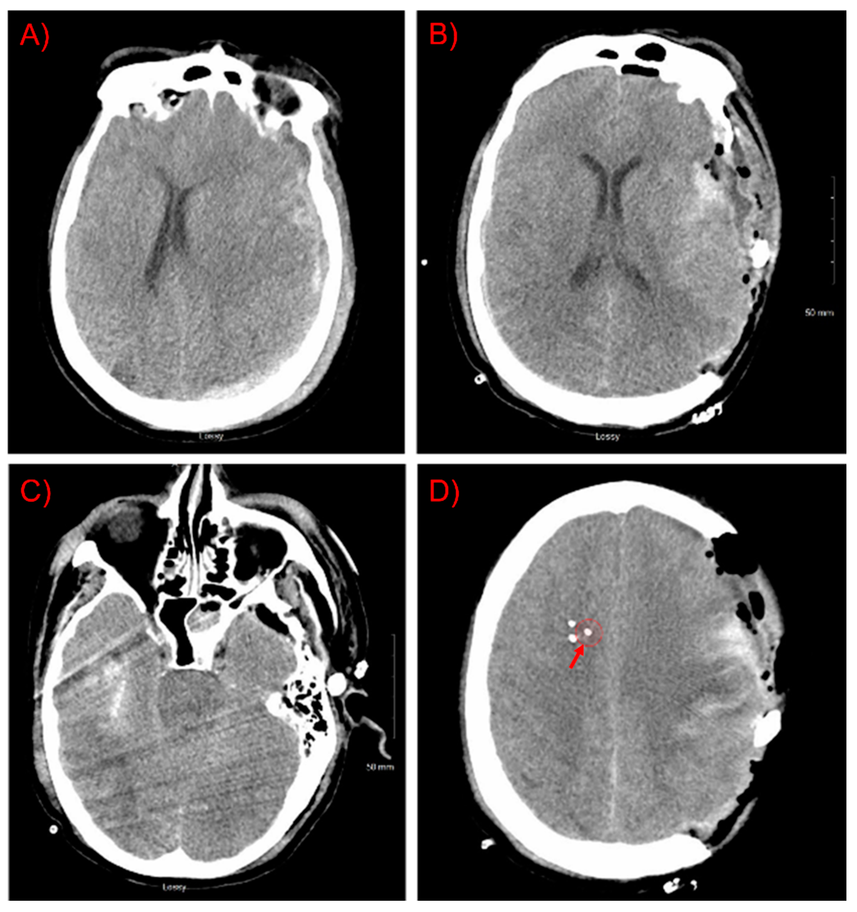 Brainsci 11 01093 g001a
