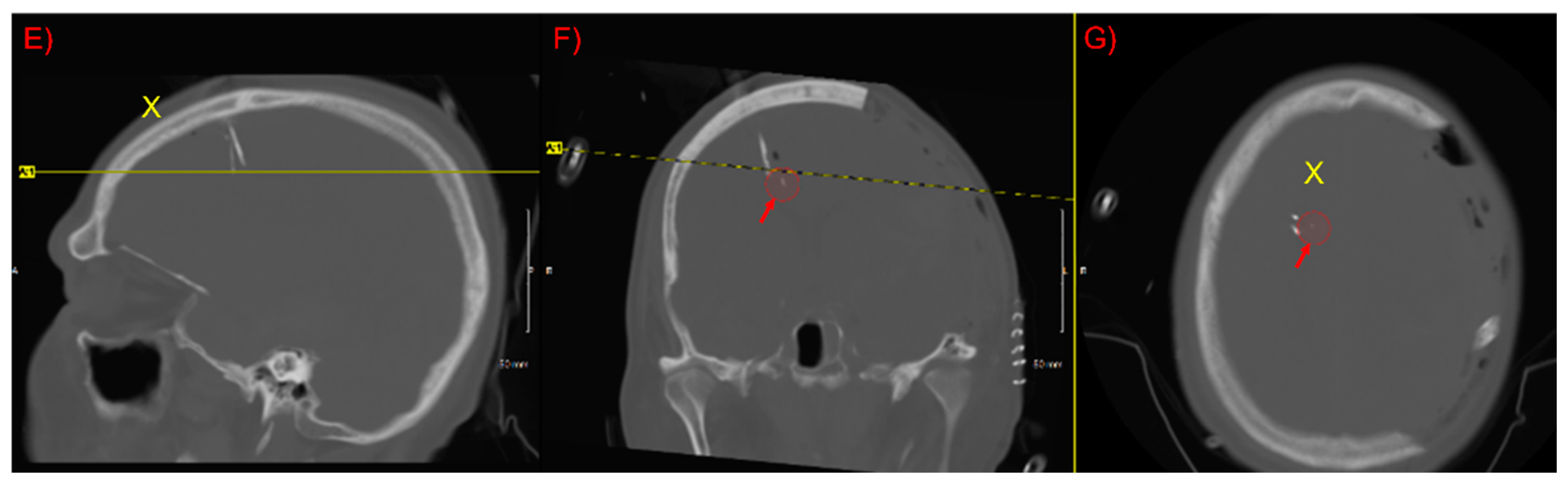 Brainsci 11 01093 g001b