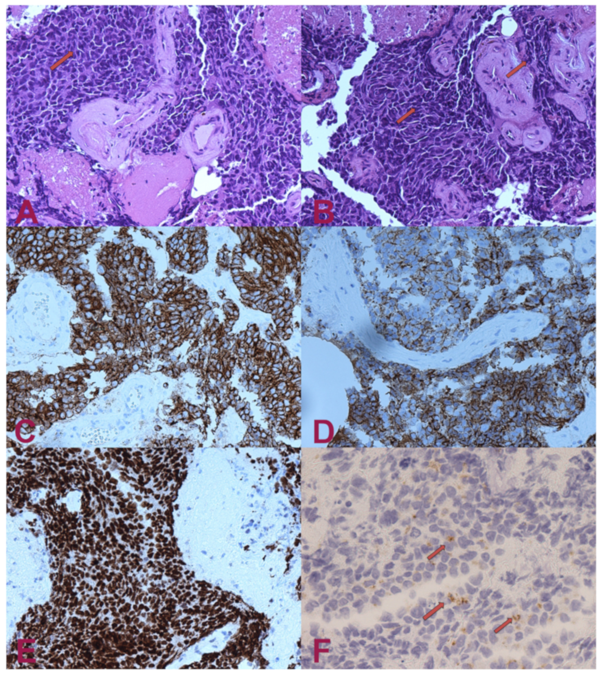 Brainsci 11 01124 g002 Brainsci 11 01124 g002
