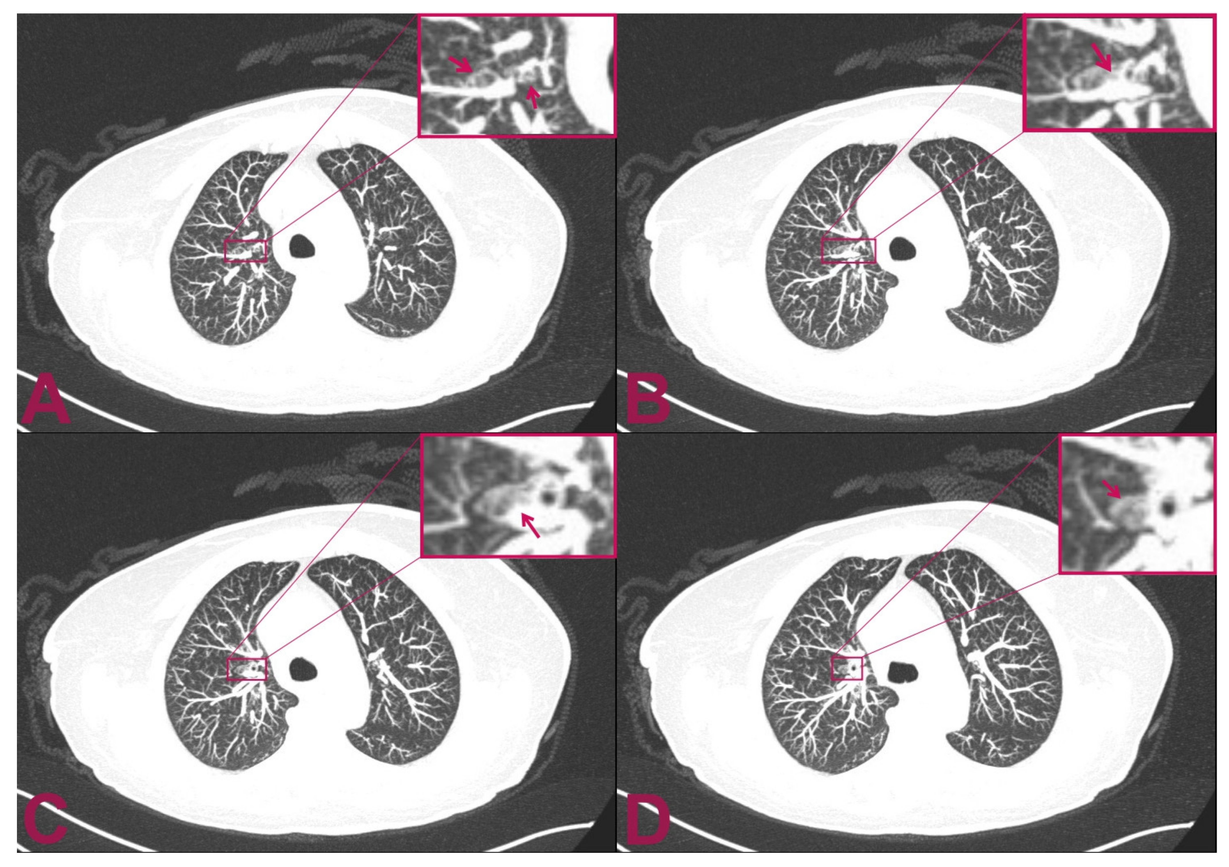 Brainsci 11 01124 g003 Brainsci 11 01124 g003