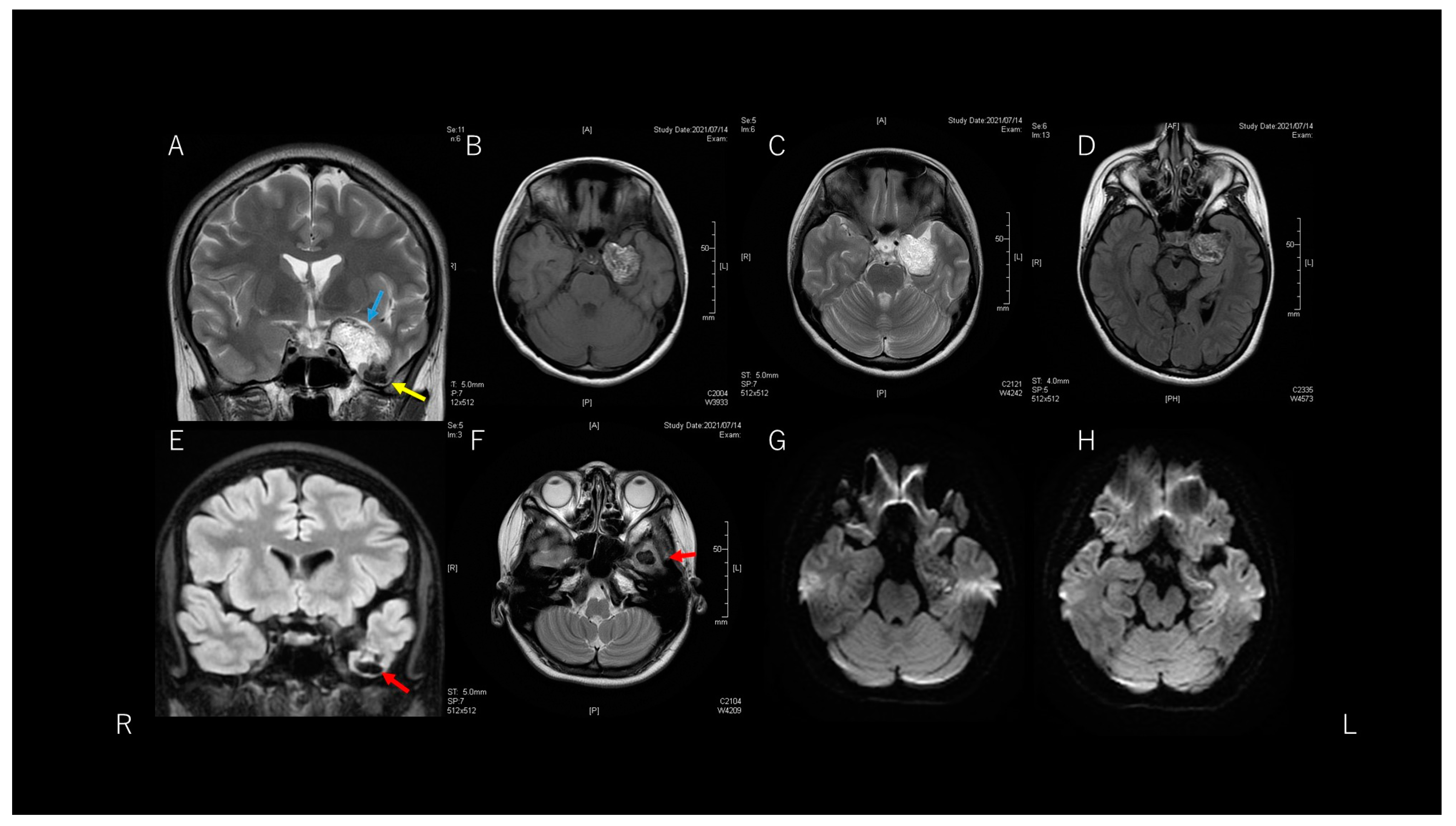 Brainsci 11 01136 g002