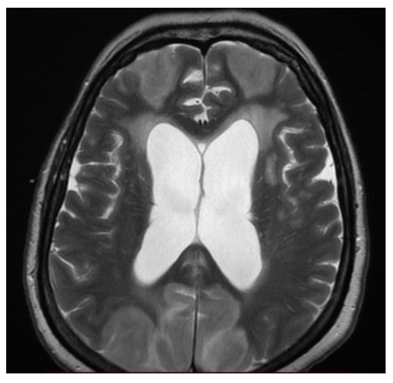 Brainsci 11 01138 g001