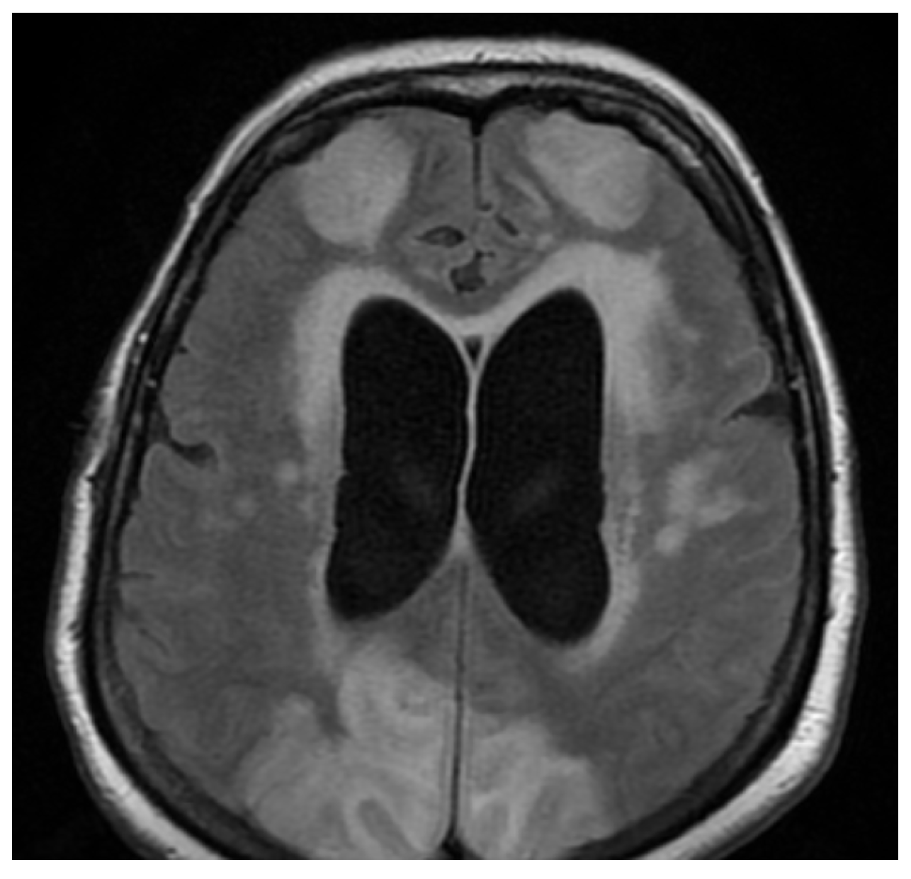 Brainsci 11 01138 g002