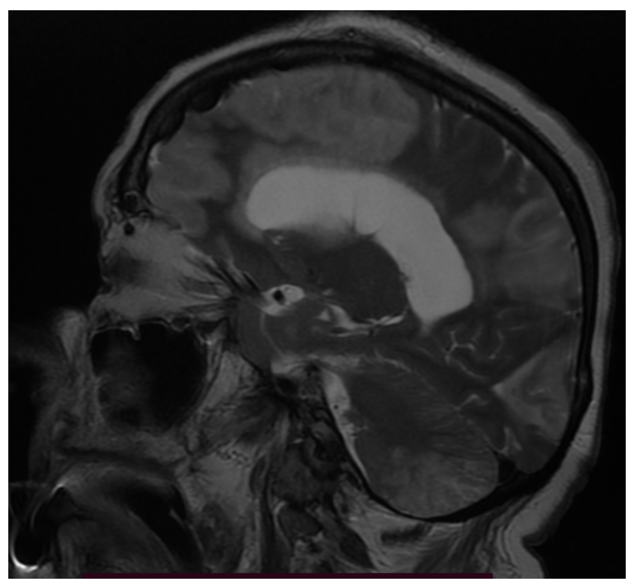 Brainsci 11 01138 g003