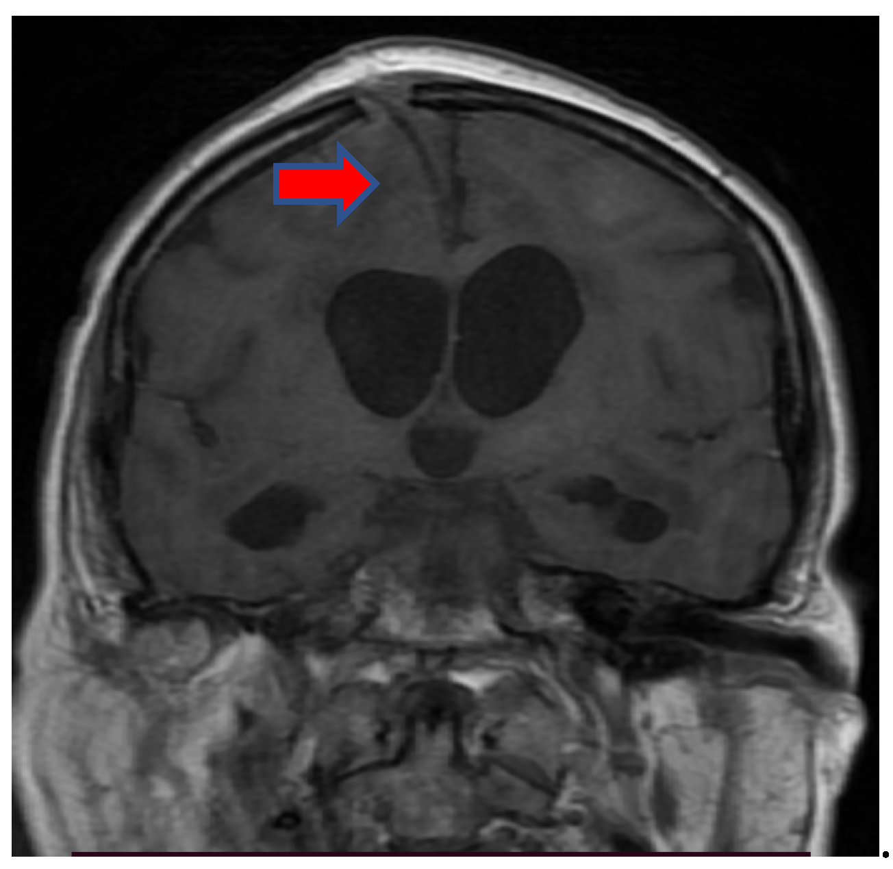 Brainsci 11 01138 g004