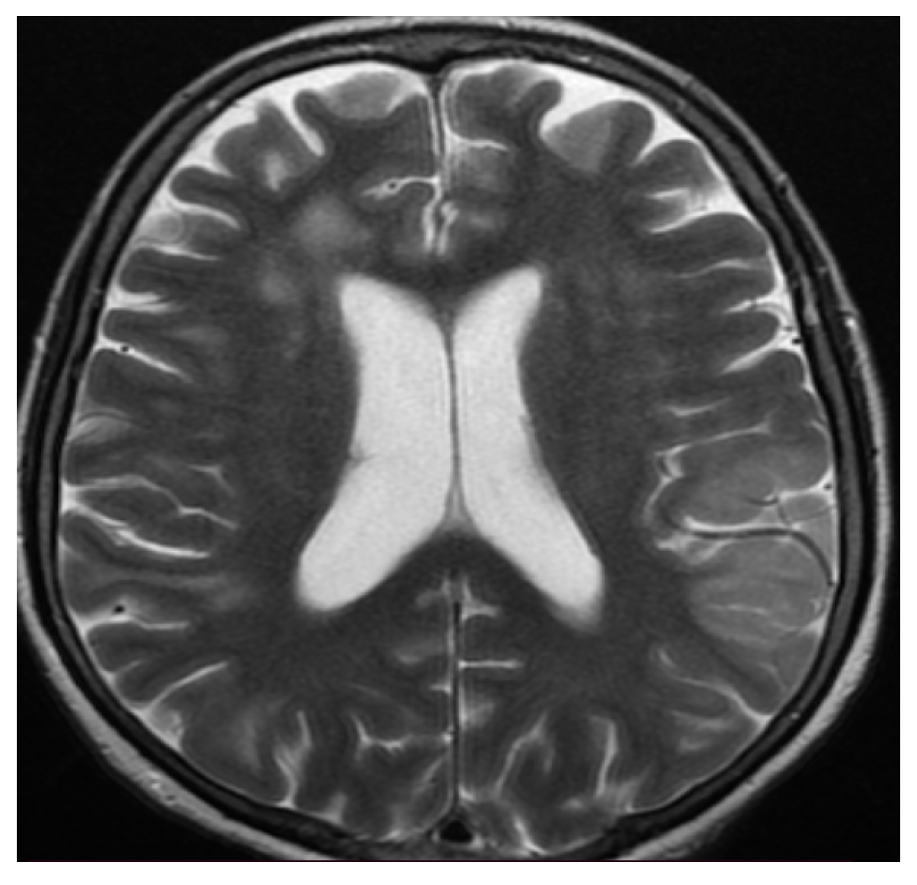 Brainsci 11 01138 g005