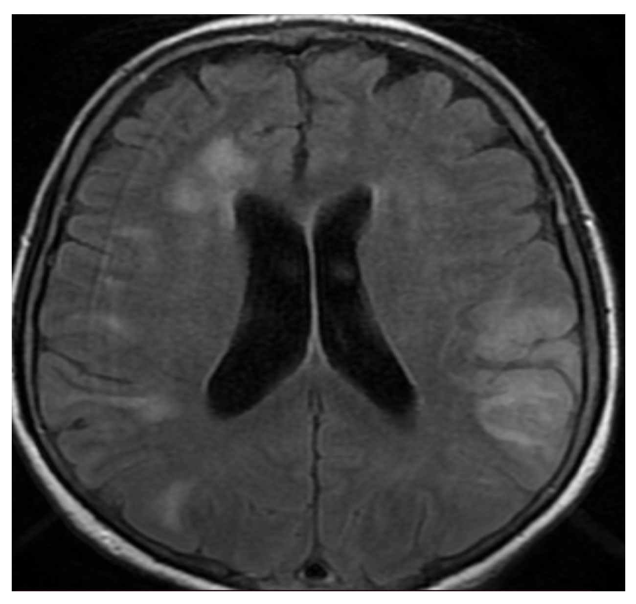 Brainsci 11 01138 g006