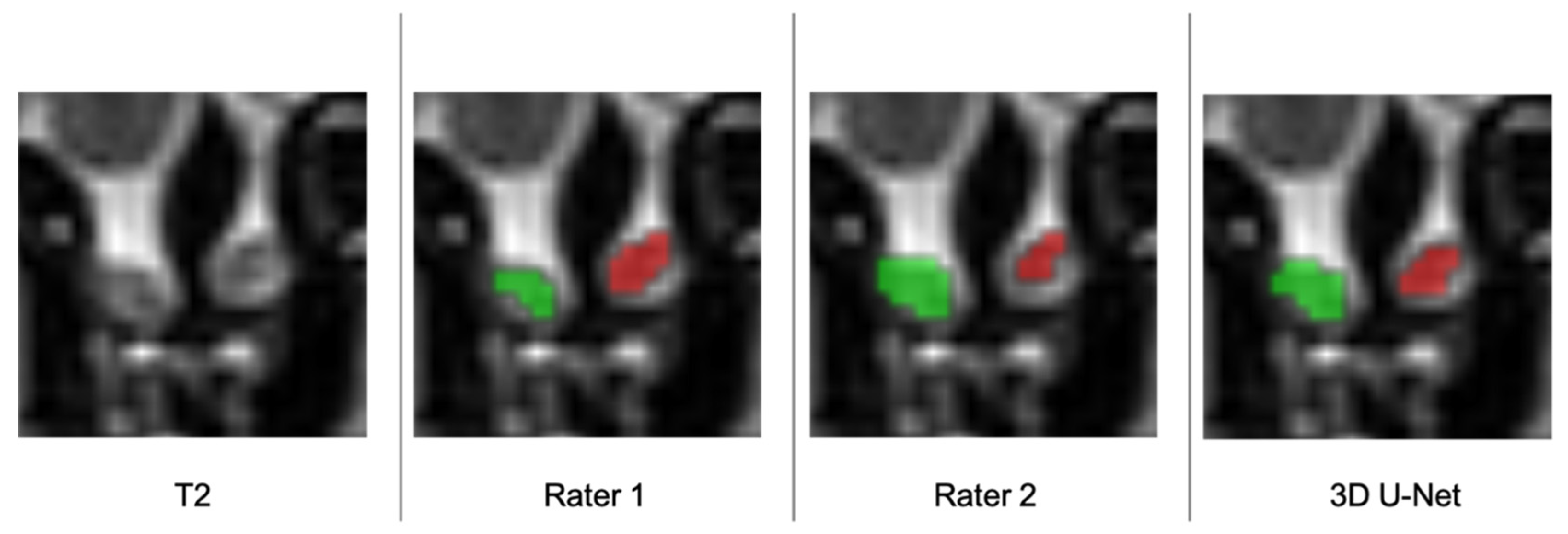Brainsci 11 01141 g005 550