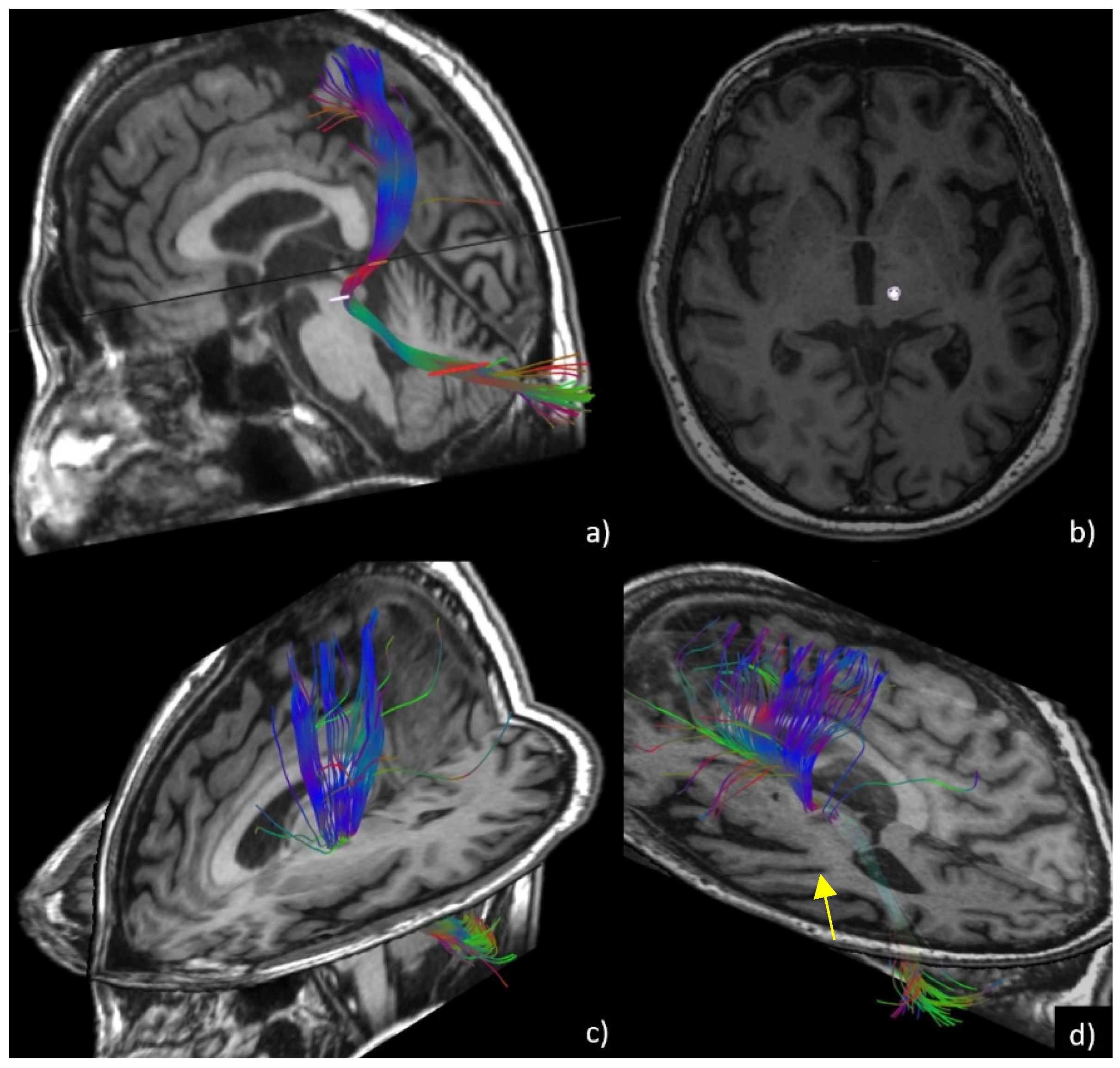 Brainsci 11 01183 g001