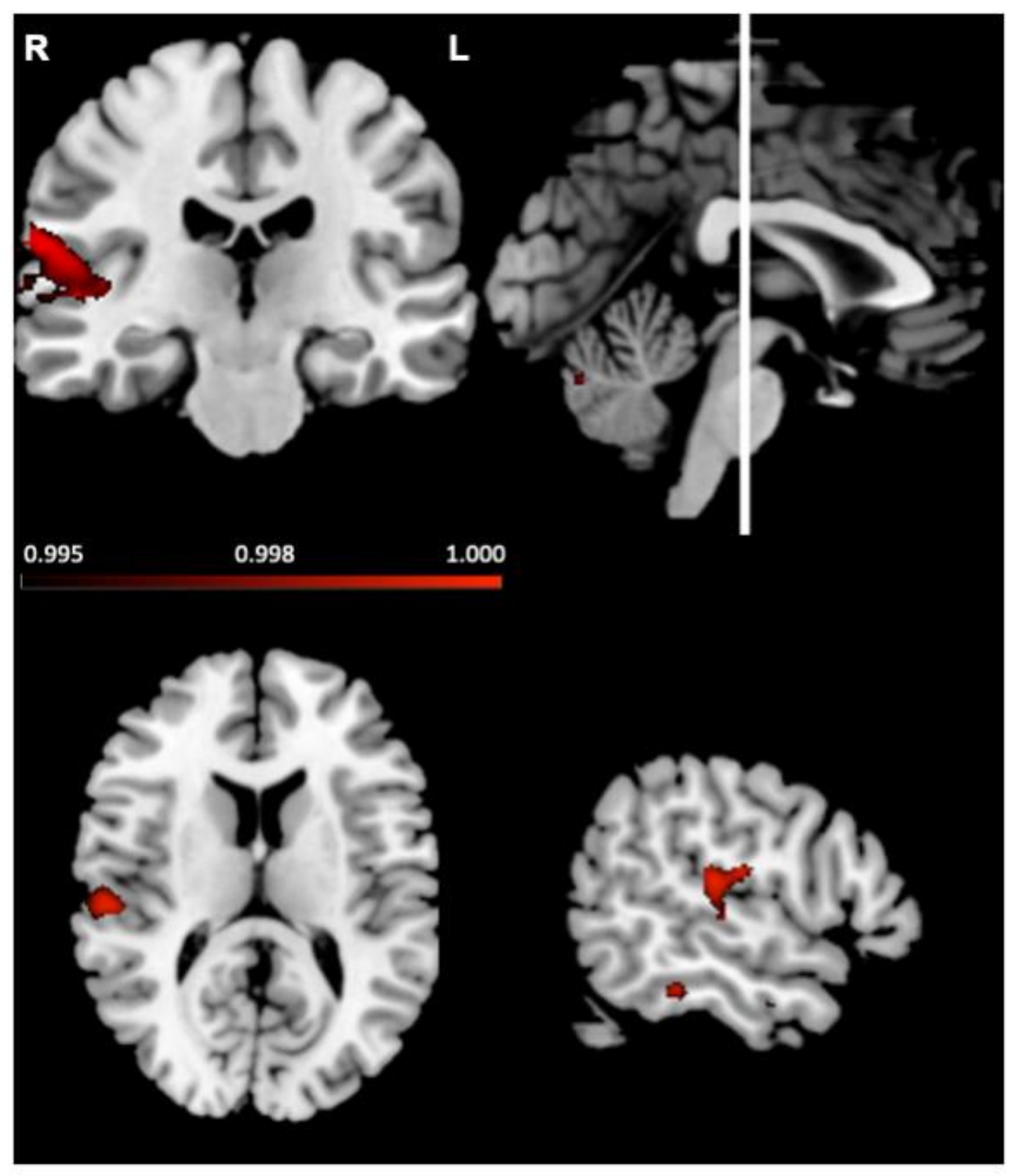 Brainsci 11 01195 g006
