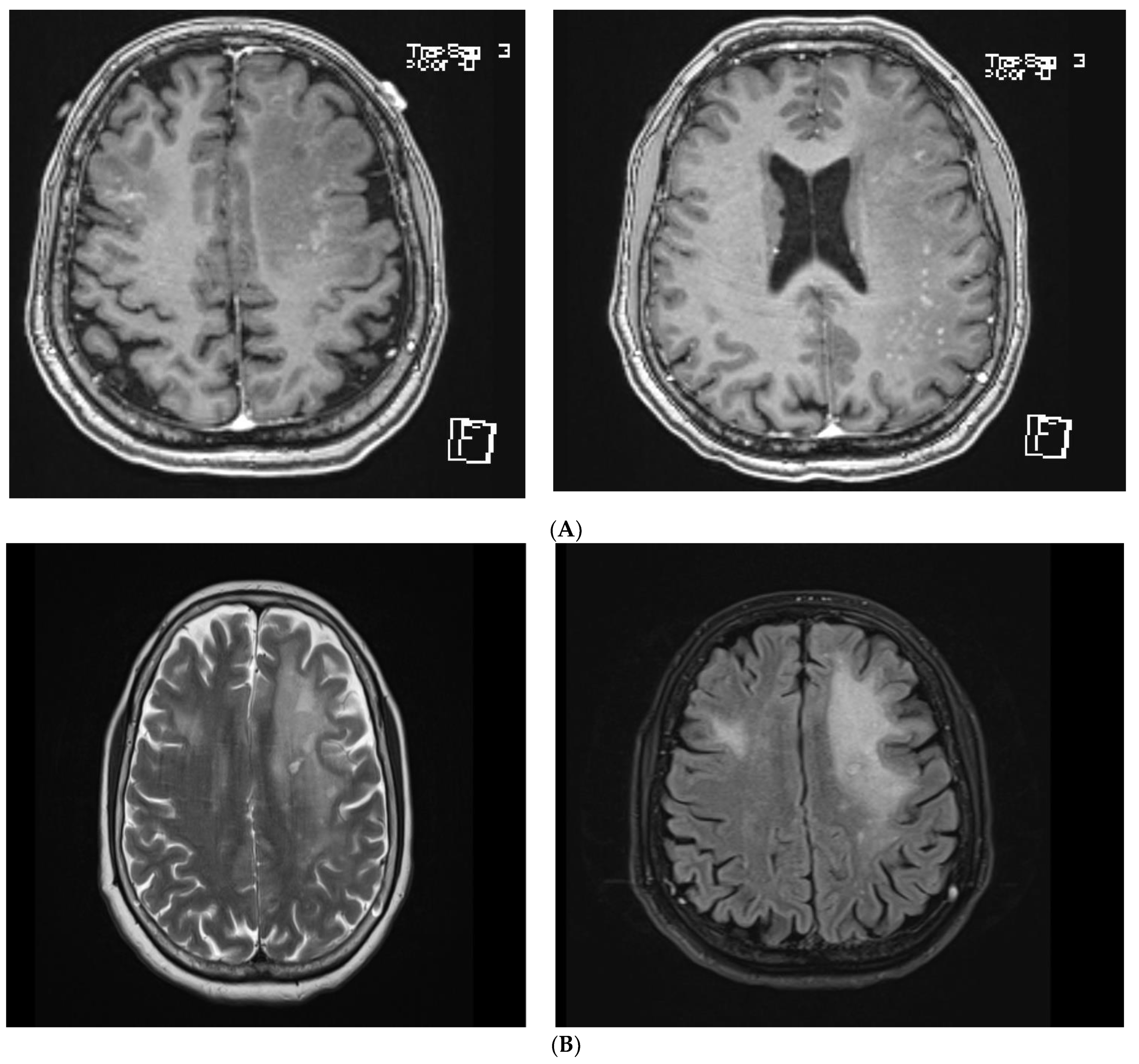 Brainsci 11 01238 g002