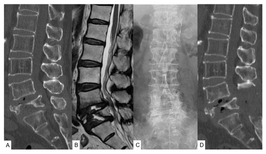 脊椎脊髄の手術 = Illustrated Surgery of Spine … 三輪書店オンラインショップ / 脊椎脊髄の手術 Illustrated