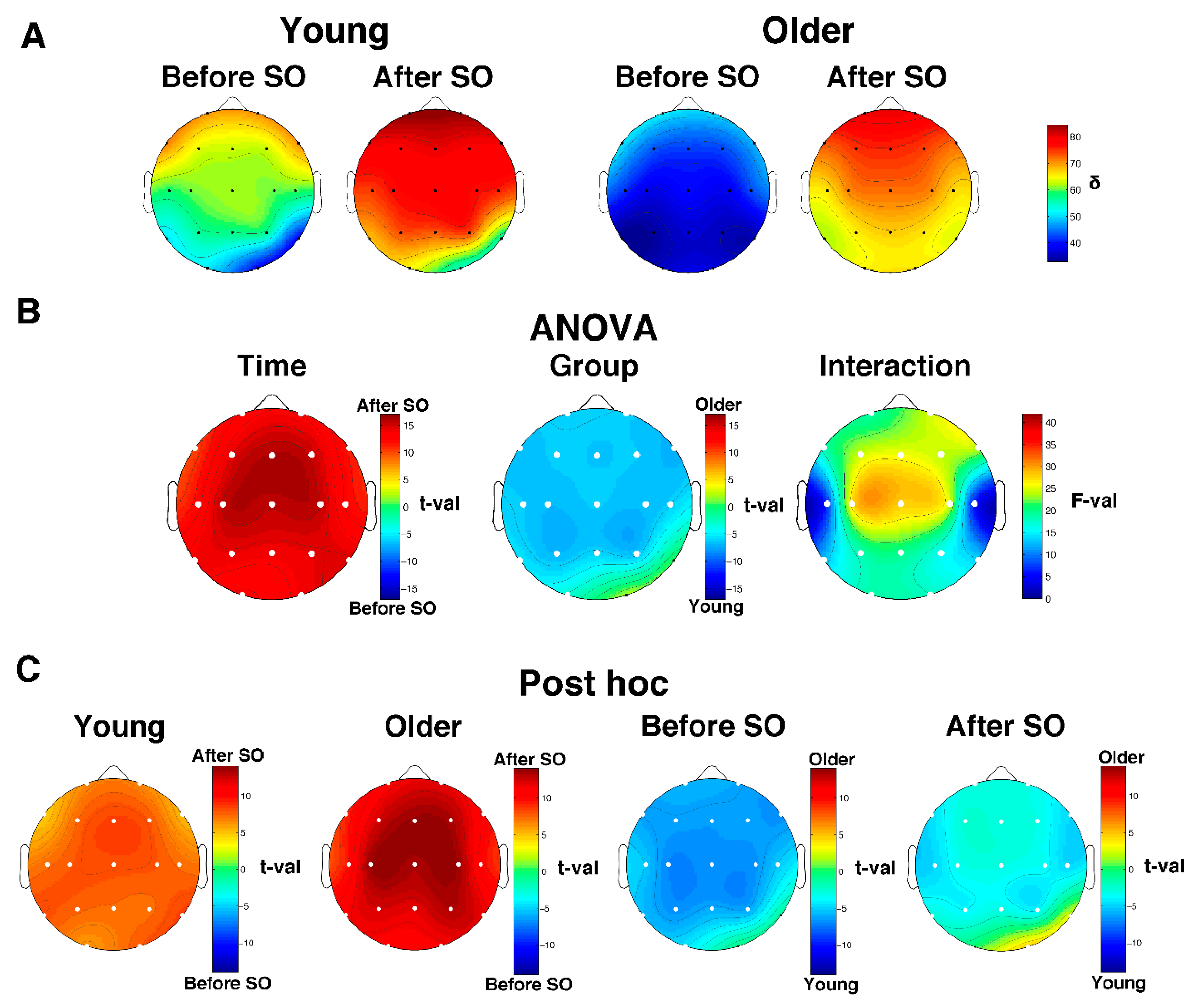 eeg 2011年 Temporo-insular enhancement of EEG low and high frequencies