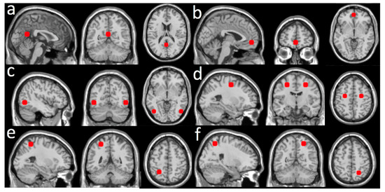 Brain Sciences, Free Full-Text