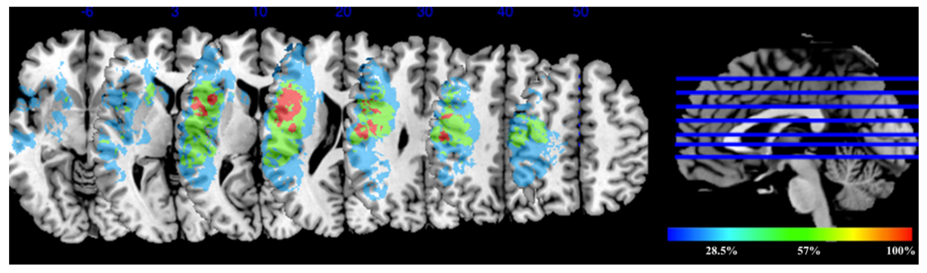 Brainsci 11 01277 g004