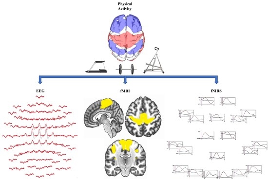 Brain Sciences Free Full-Text An Overview on Cognitive Function Enhancement through Physical Exercises photo