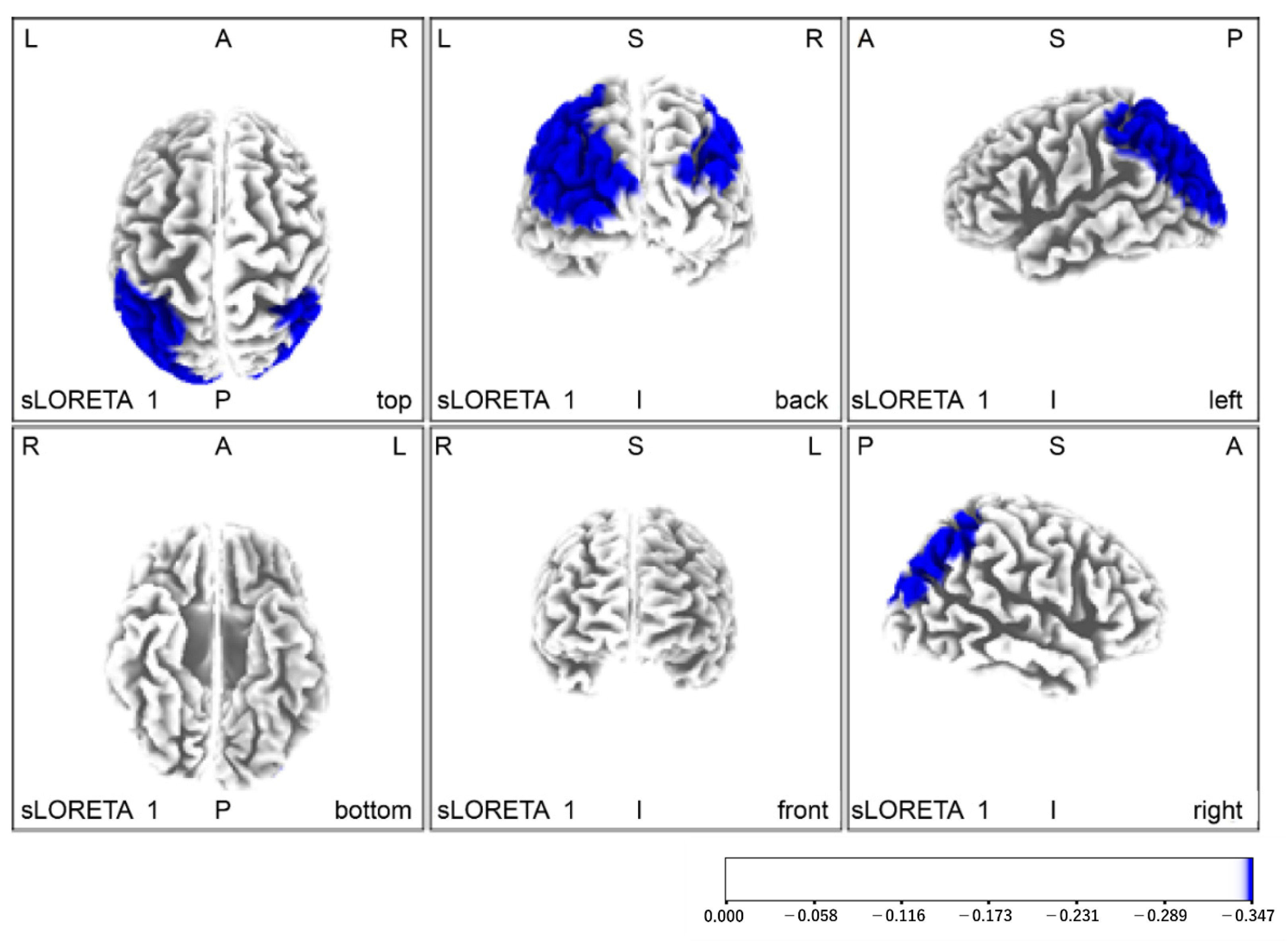 Brainsci 11 01314 g005 Brainsci 11 01314 g005