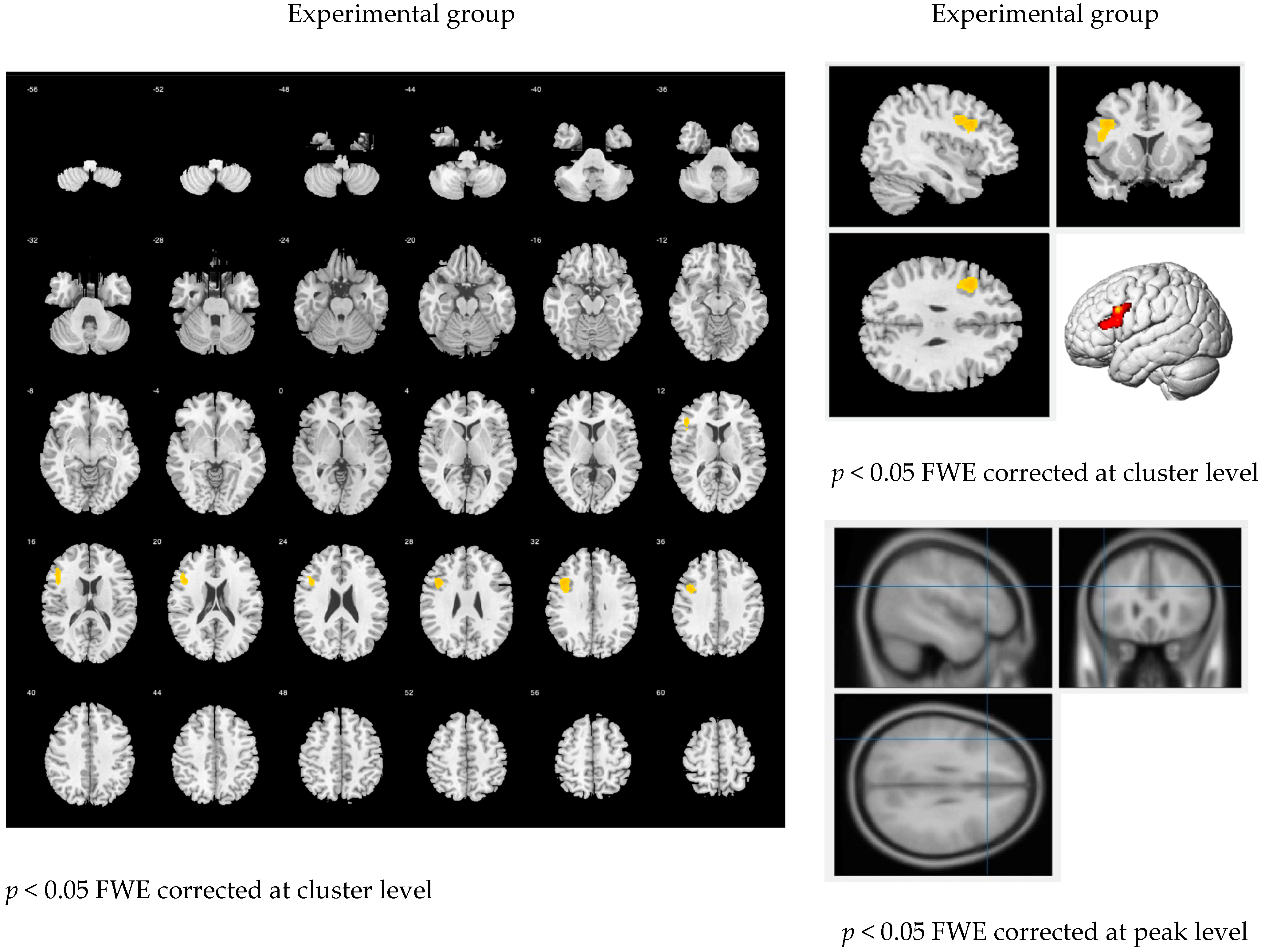 Brainsci 11 01378 g005a