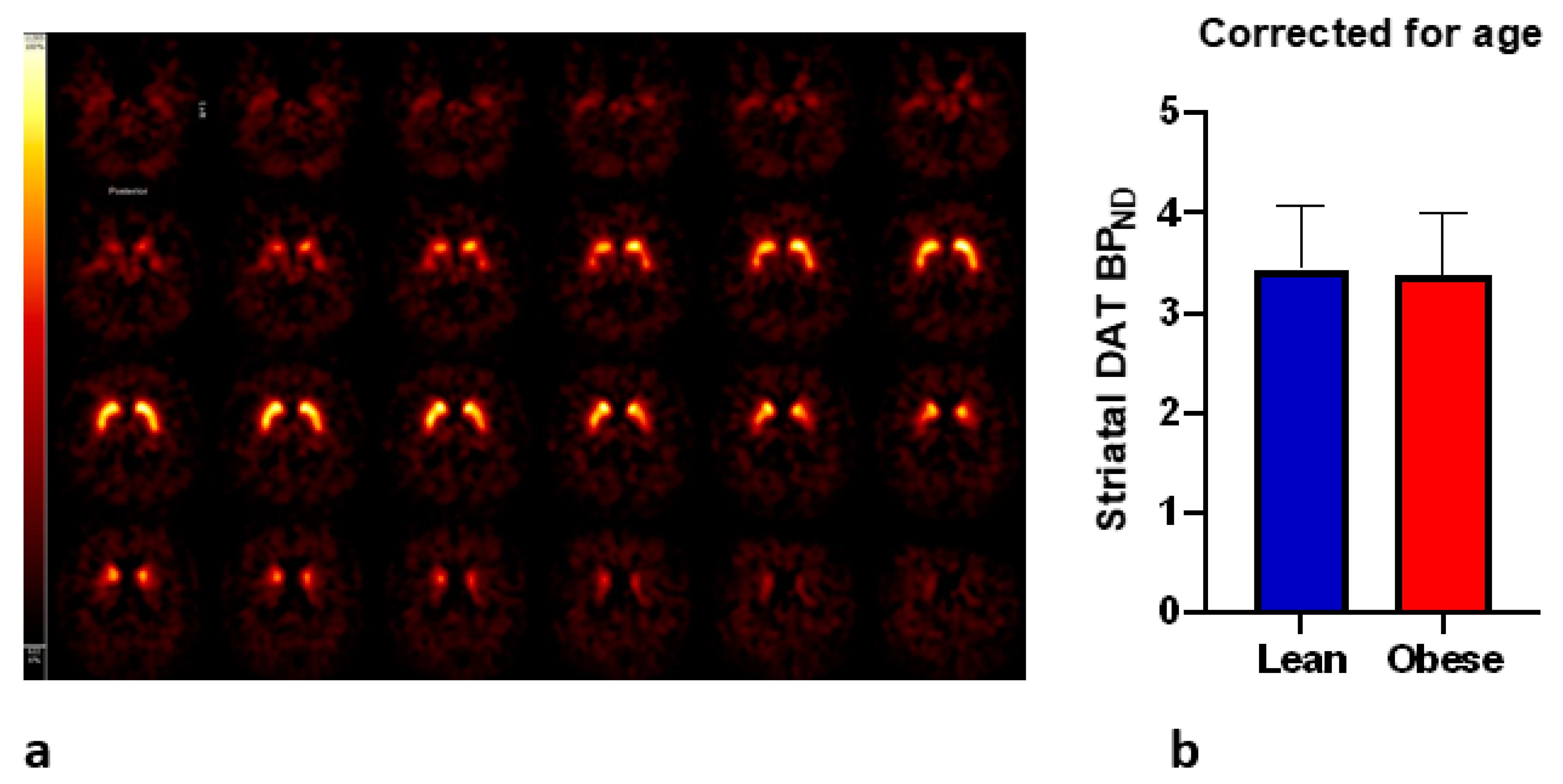 Brainsci 11 01428 g001