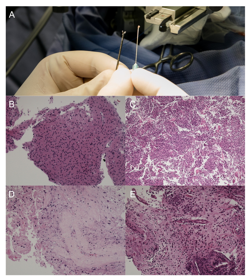 Brainsci 11 01432 g004