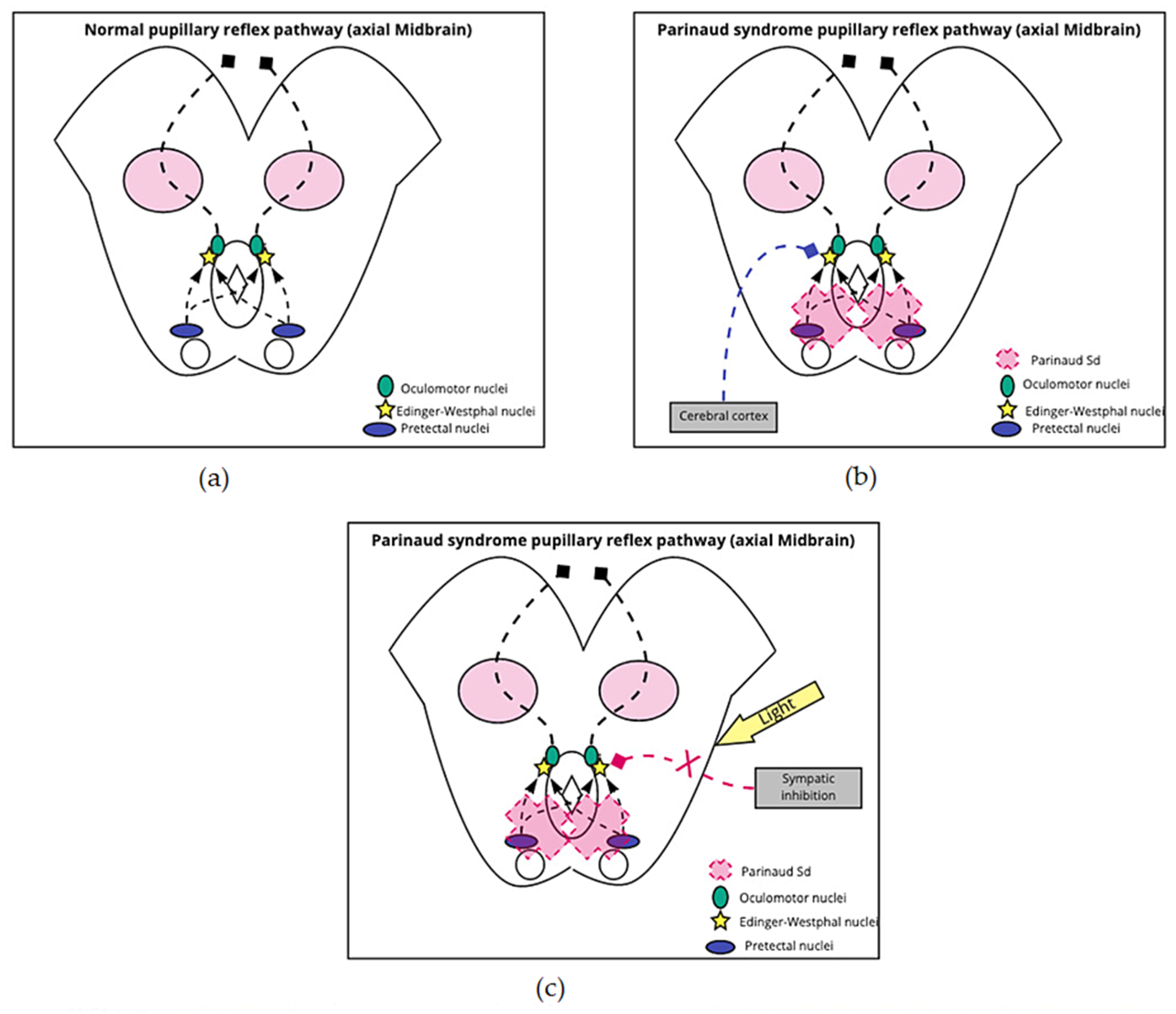 Brainsci 11 01469 g002