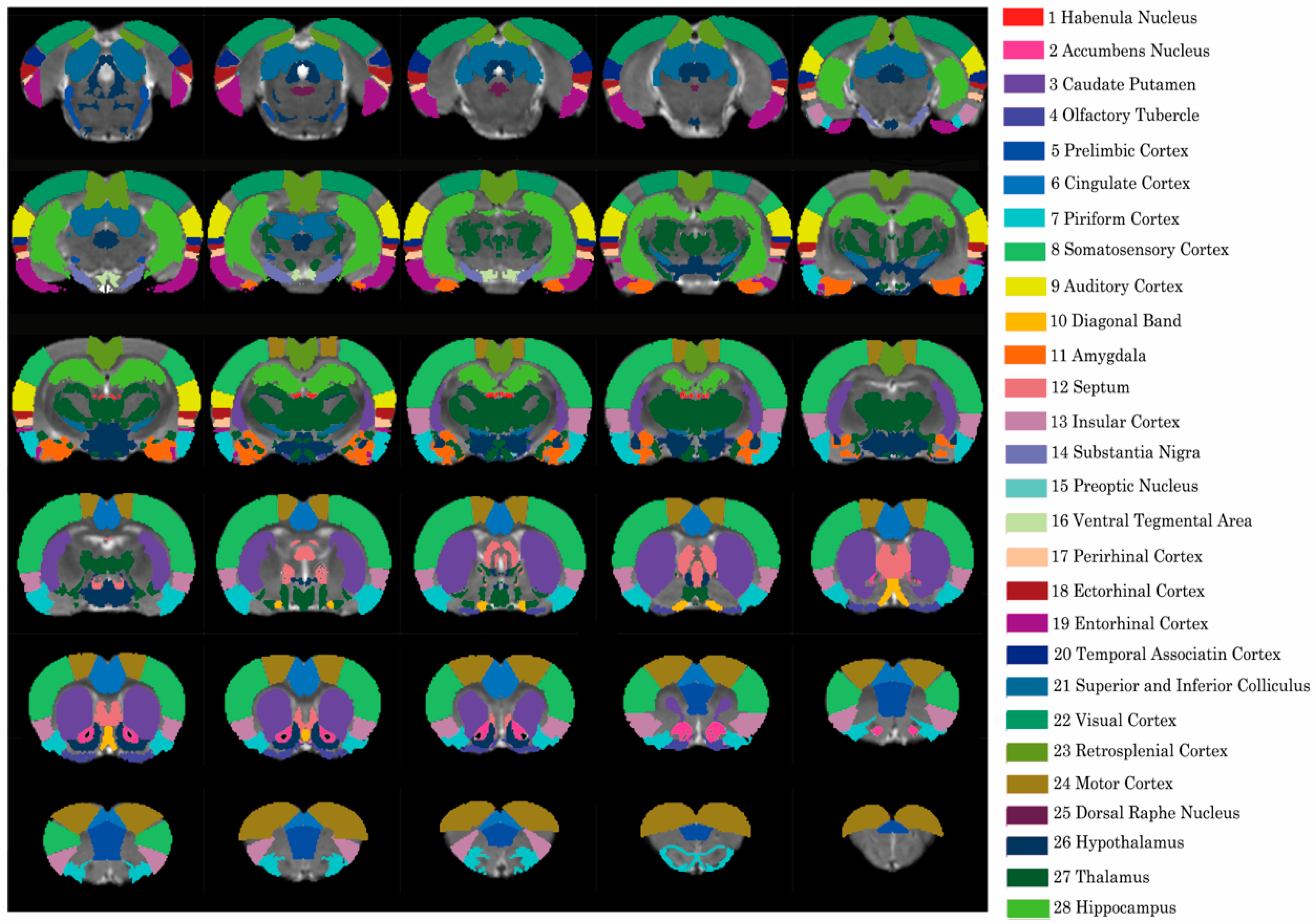 Brainsci 11 01474 g001