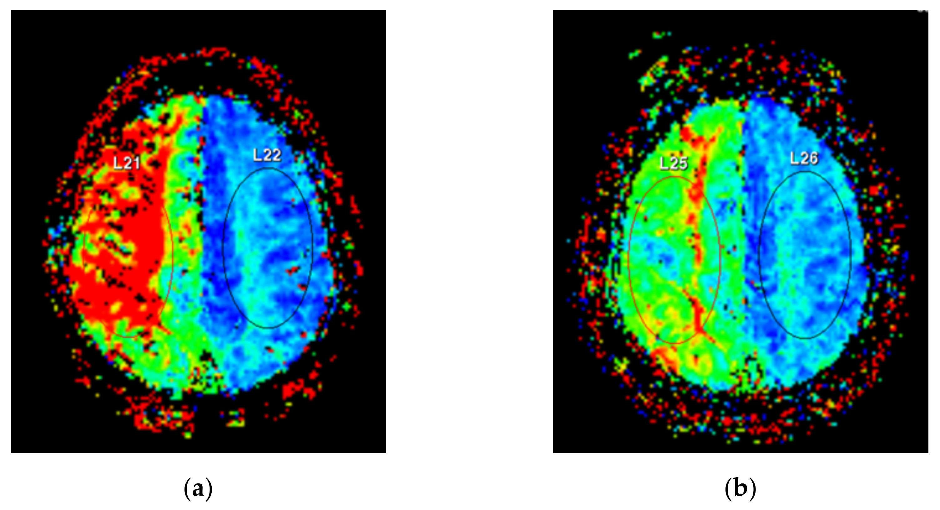 Brainsci 11 01478 g004 550