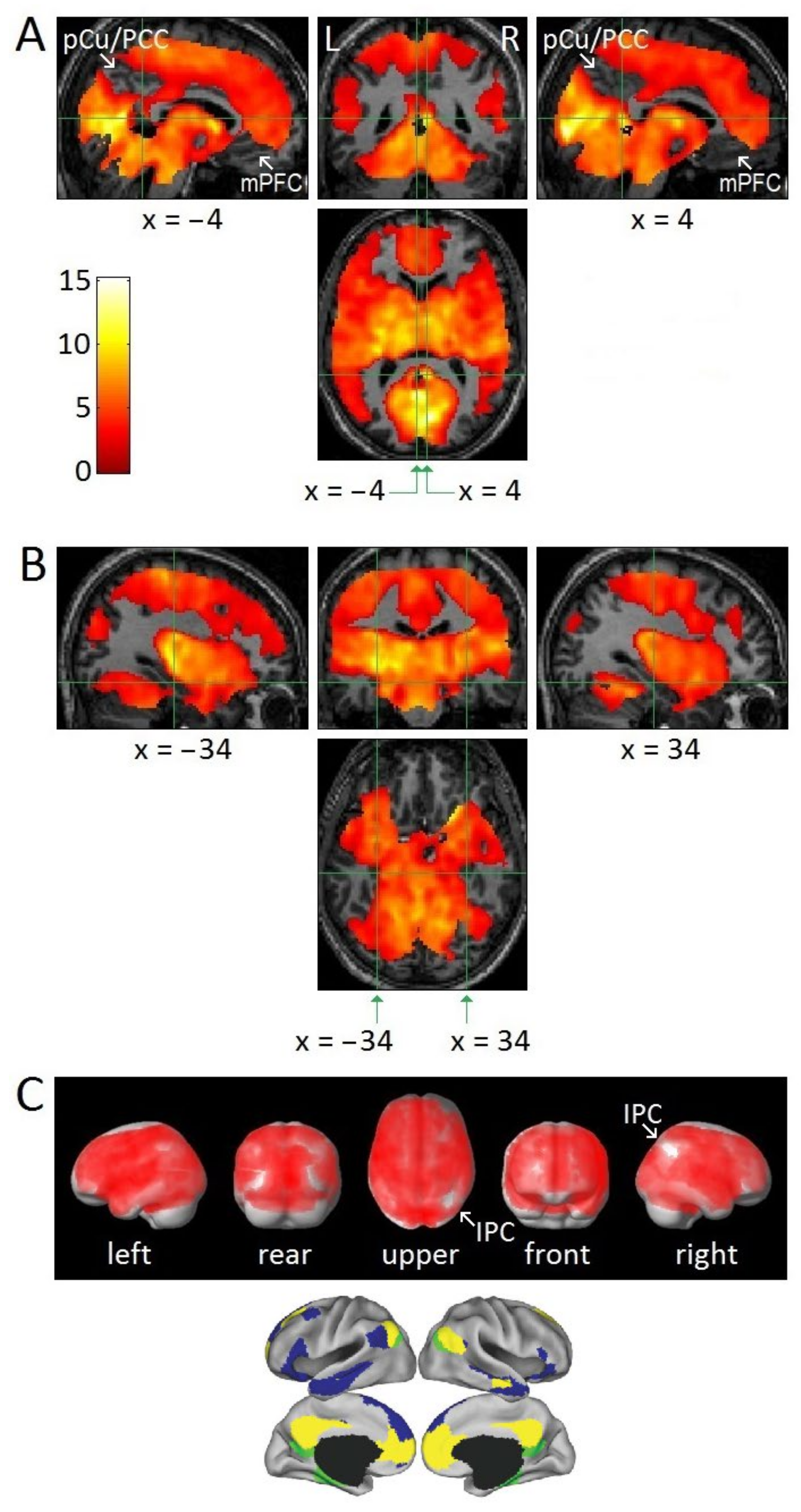 2732px x 5152px - Brain Sciences | Free Full-Text | fMRI Evidence for Default Mode Network  Deactivation Associated with Rapid Eye Movements in Sleep