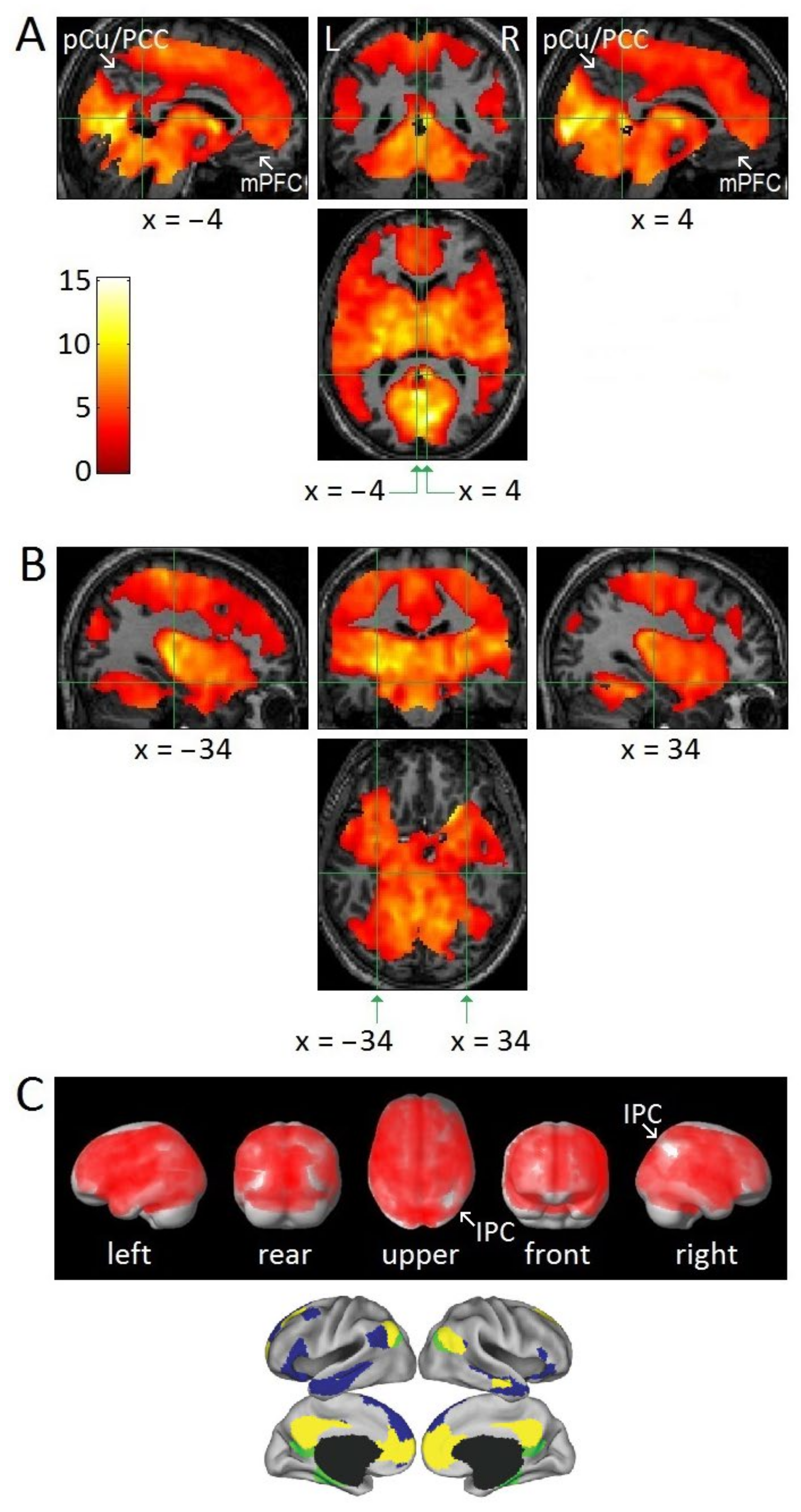 Large-scale functional brain networks in human non-rapid eye movement  sleep: insights from combined electroencephalographic/functional magnetic  resonance imaging studies