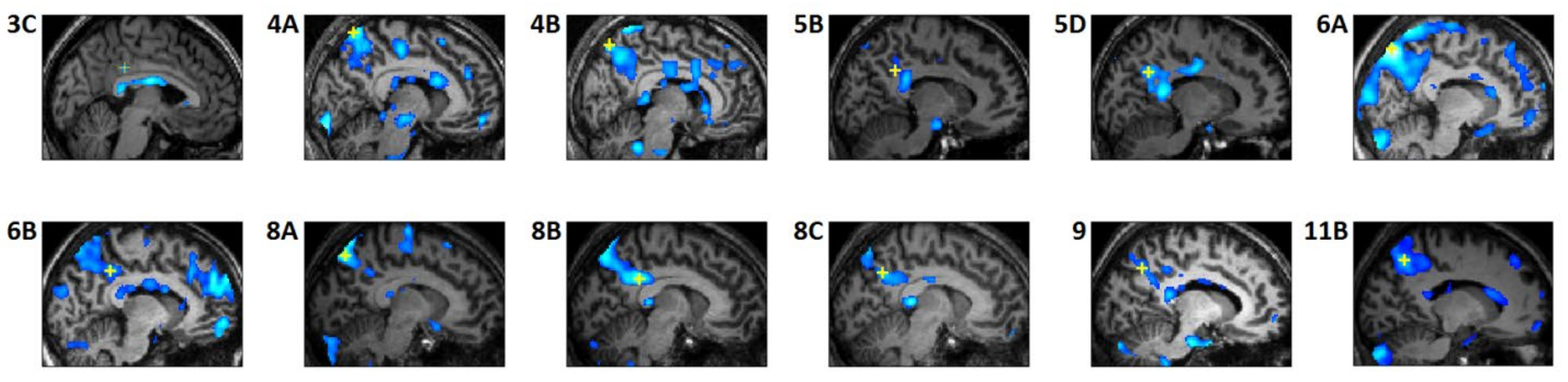 Brainsci 11 01528 g002