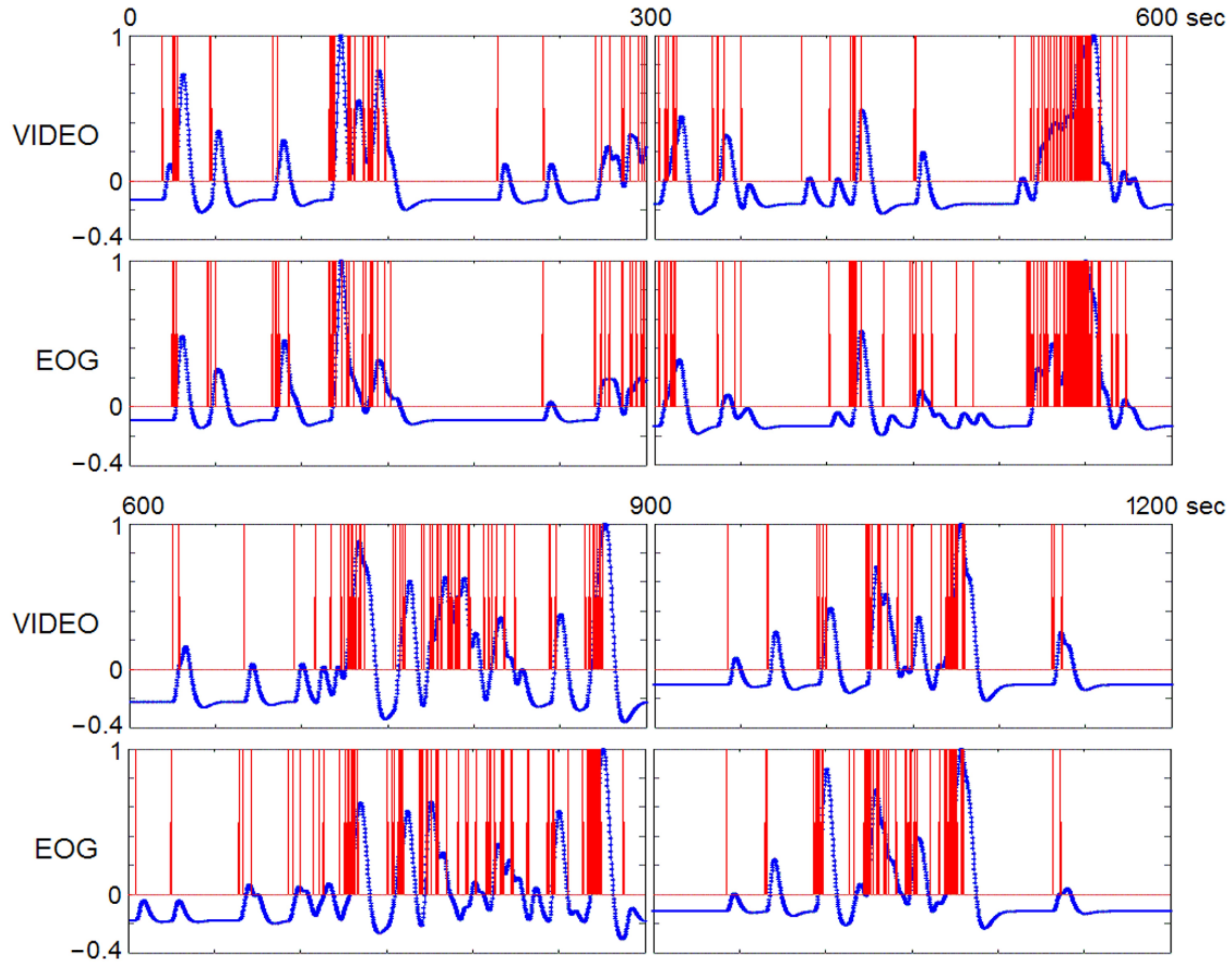 Brainsci 11 01528 g005