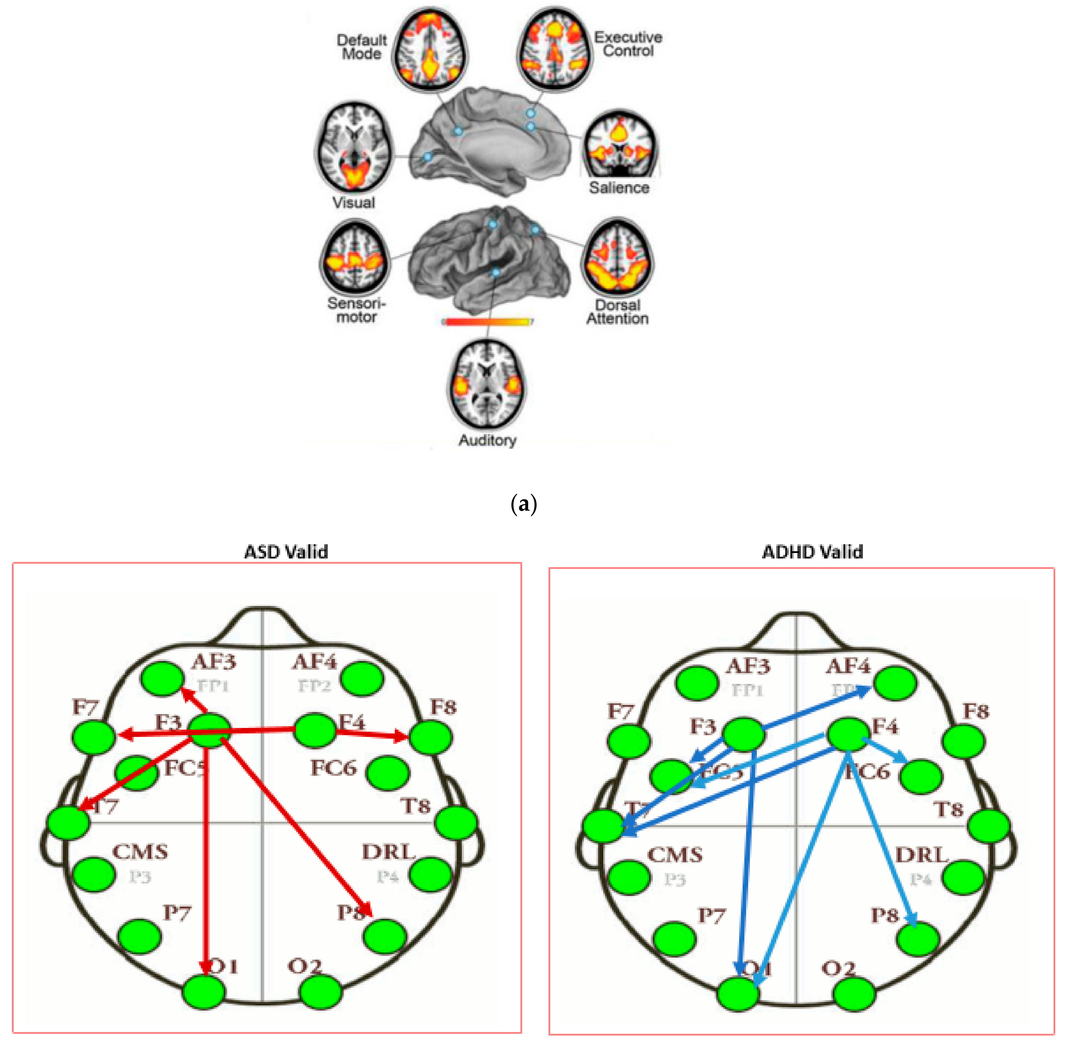 Brainsci 11 01531 g031a Brainsci 11 01531 g031a