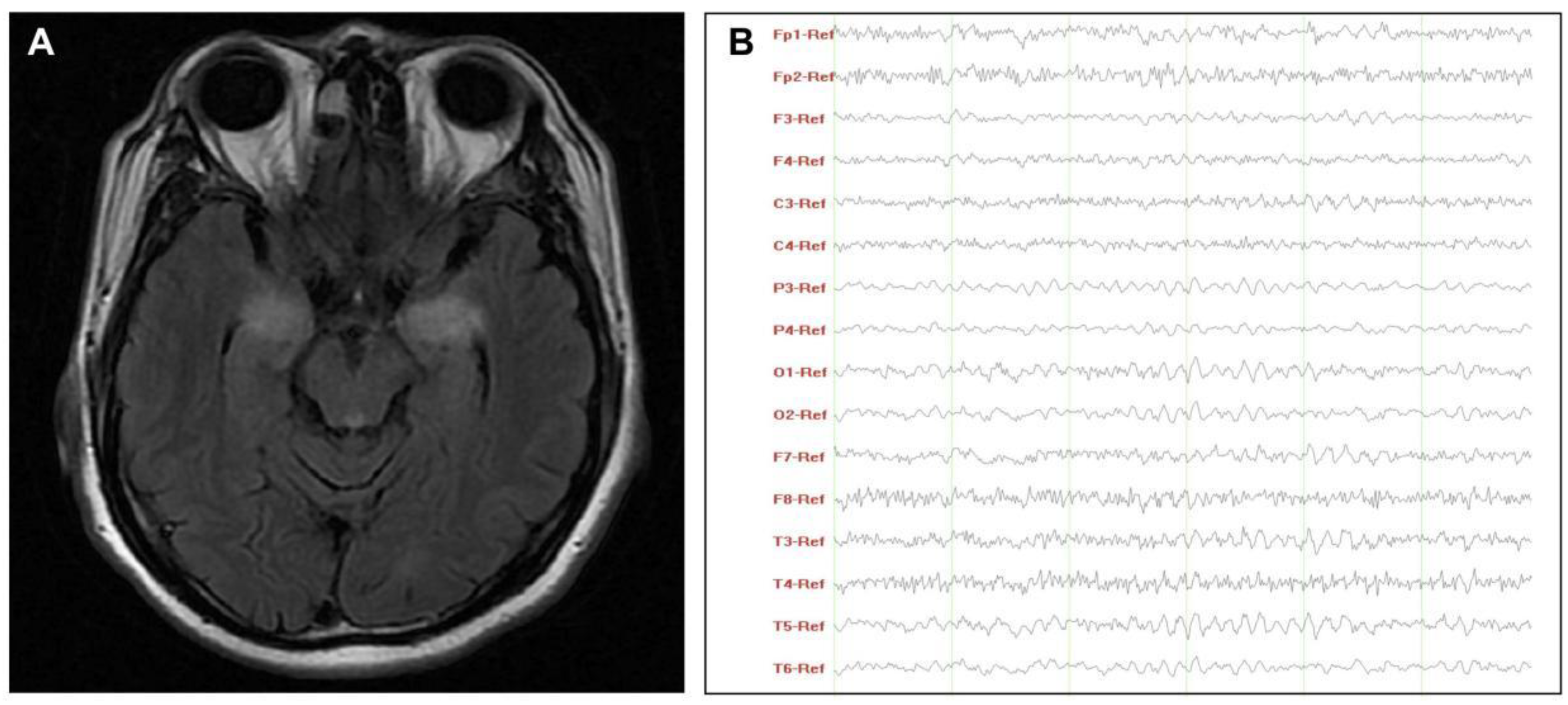 Brainsci 11 01577 g001