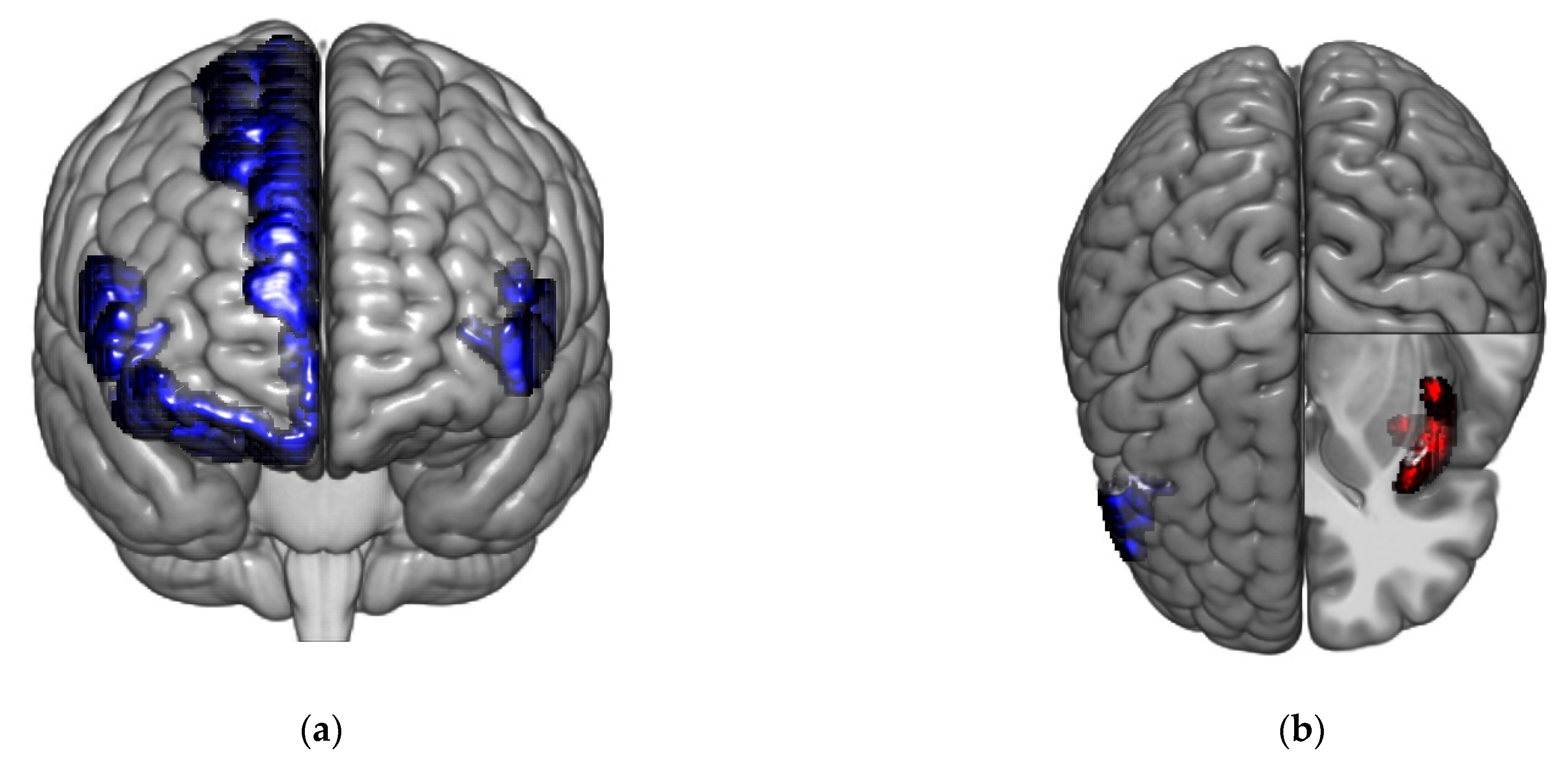Brainsci 11 01580 g003 550