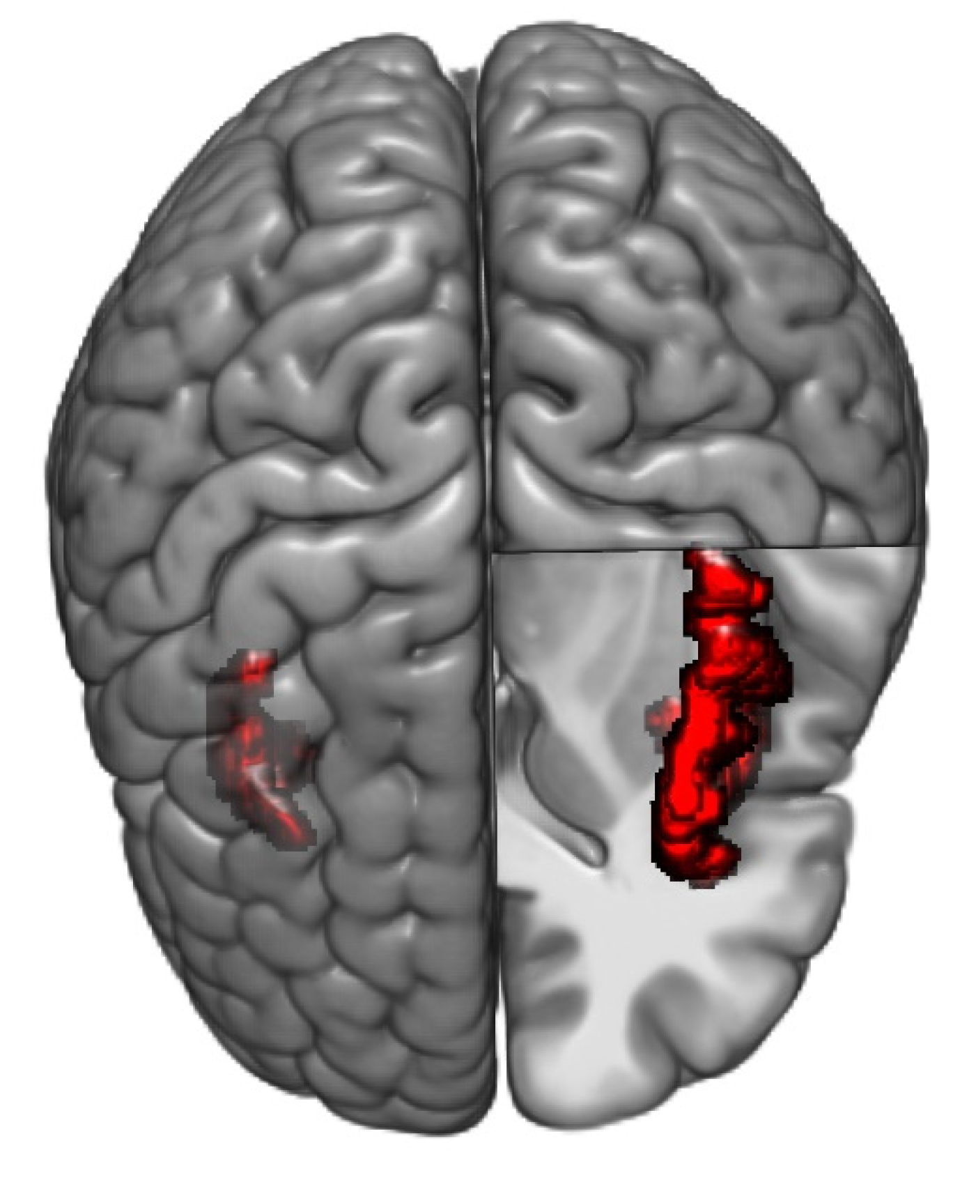 Brainsci 11 01580 g004 550