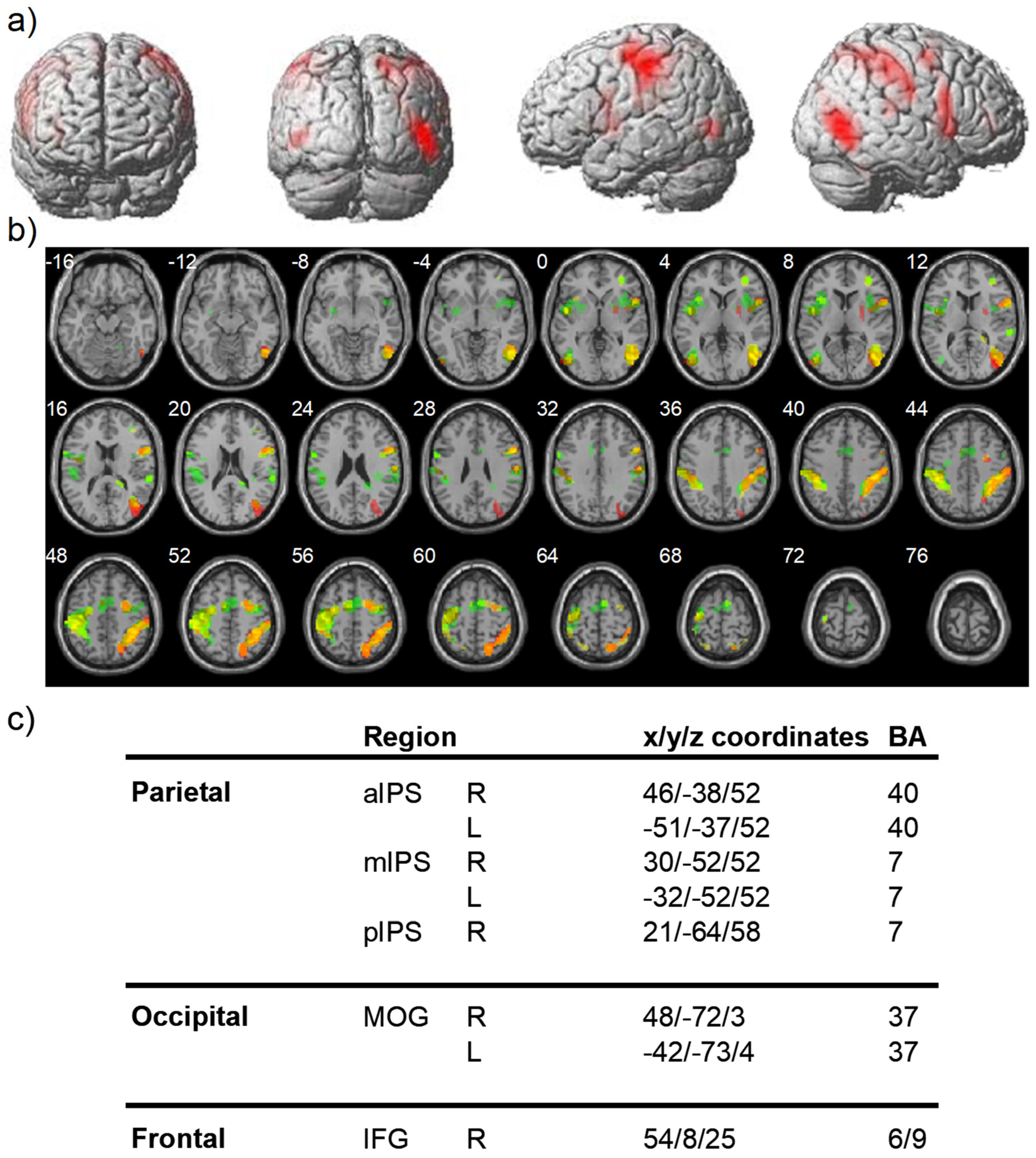 Brainsci 11 01584 g003