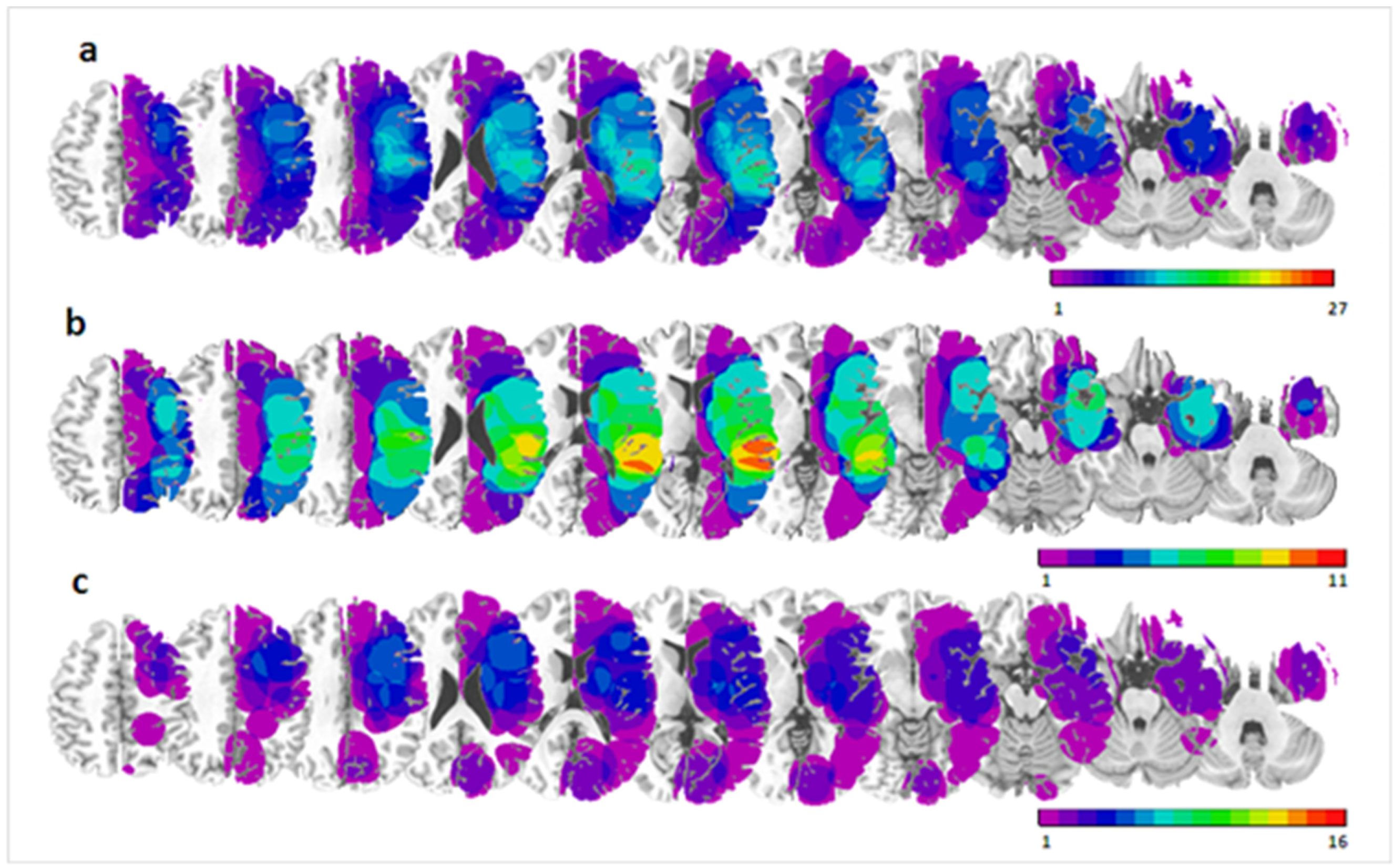 Brainsci 11 01584 g005