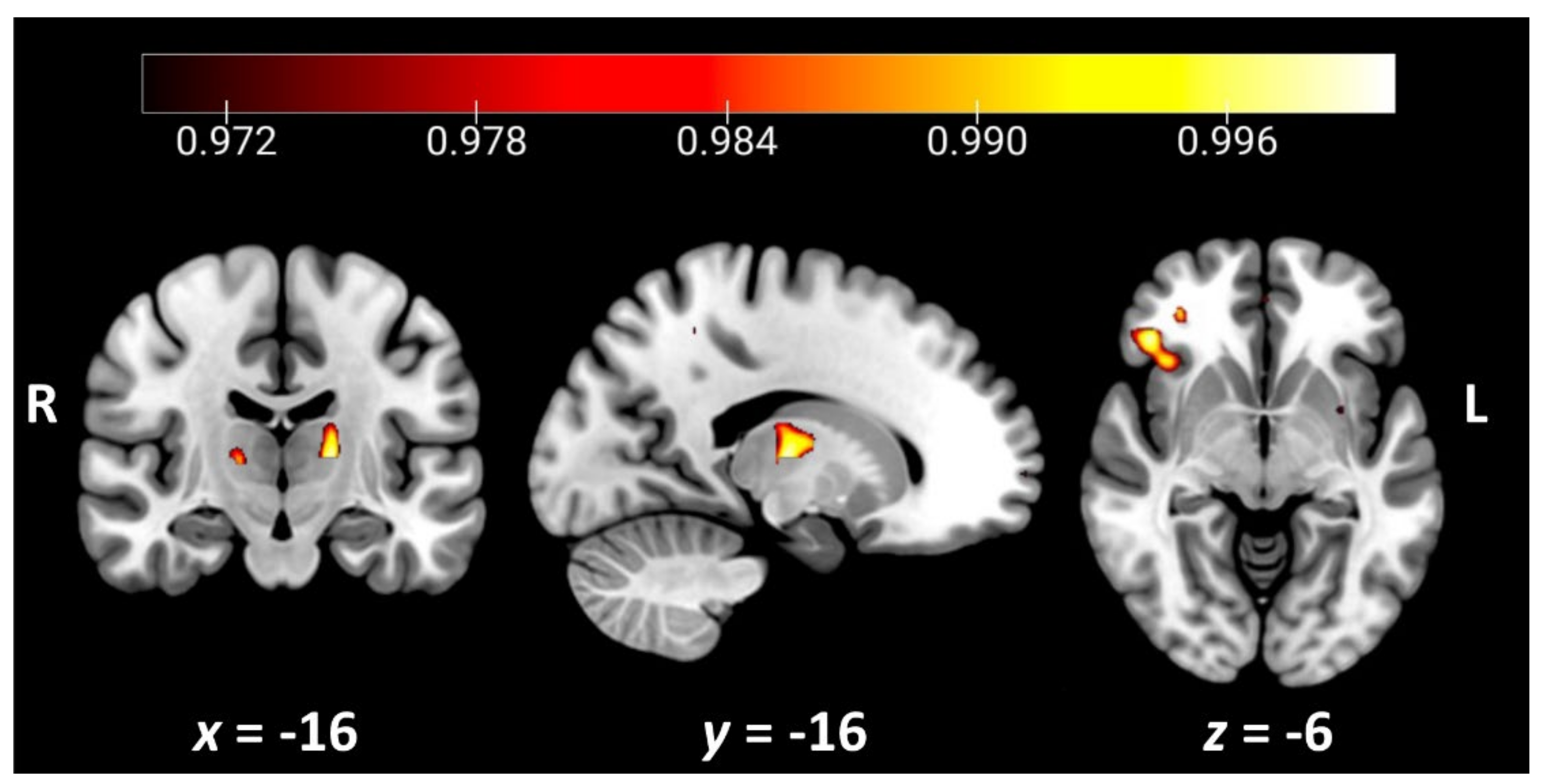 Brainsci 11 01600 g003