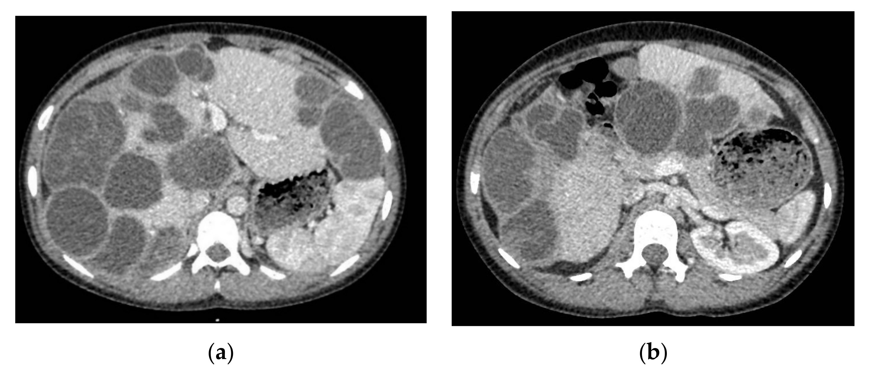 Brainsci 11 01604 g005