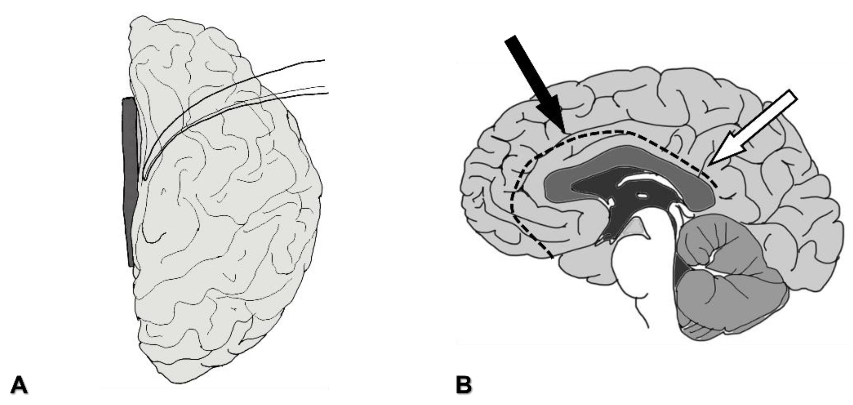 Brainsci 11 01608 g002 550