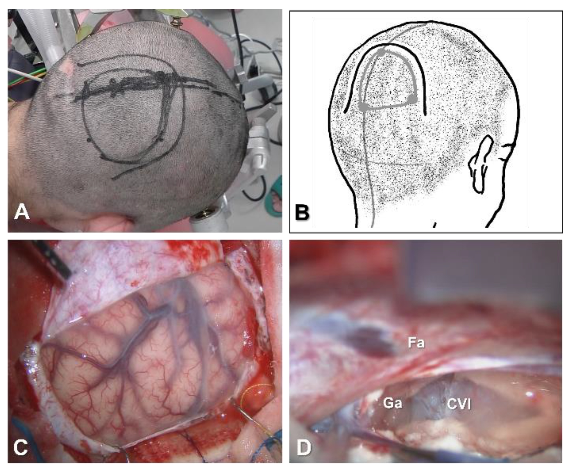 Brainsci 11 01608 g005 550