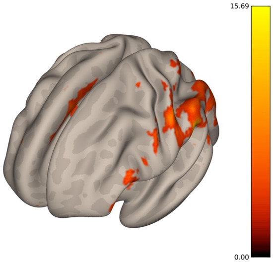 wang 2011 human brain mapping fmri wang 2011 human brain mapping fmri